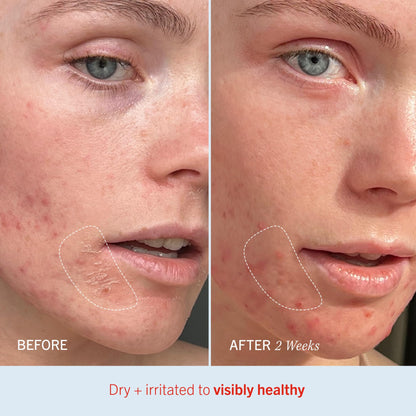 First Aid Beauty intense hydration moisturizer skin protectant packaging