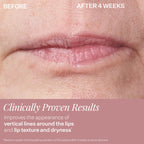 Application of StriVectin DoubleFix For Lips on model mouth area.