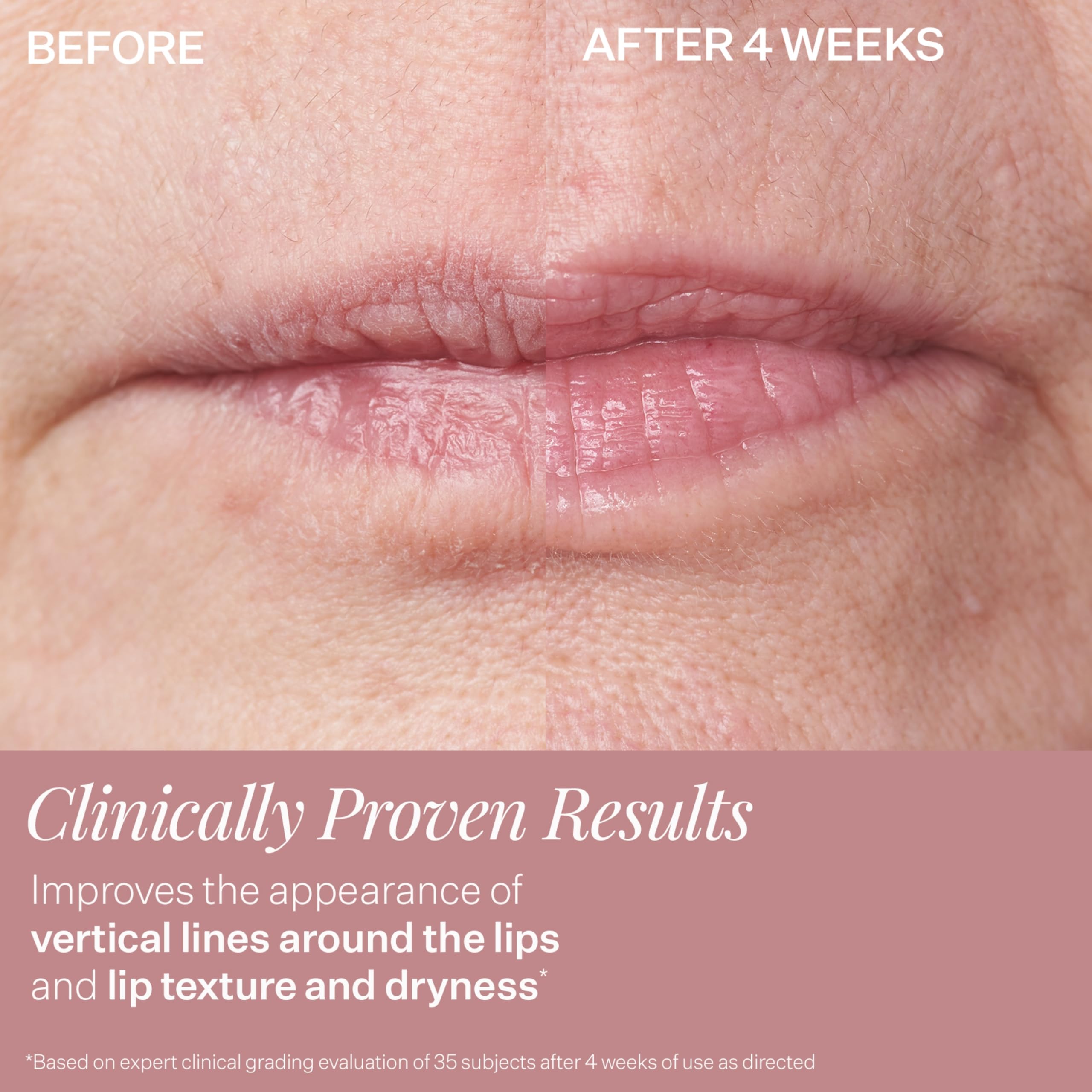 Close up of StriVectin DoubleFix for lips branding