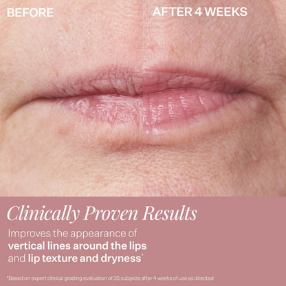 Close up of StriVectin DoubleFix for lips branding