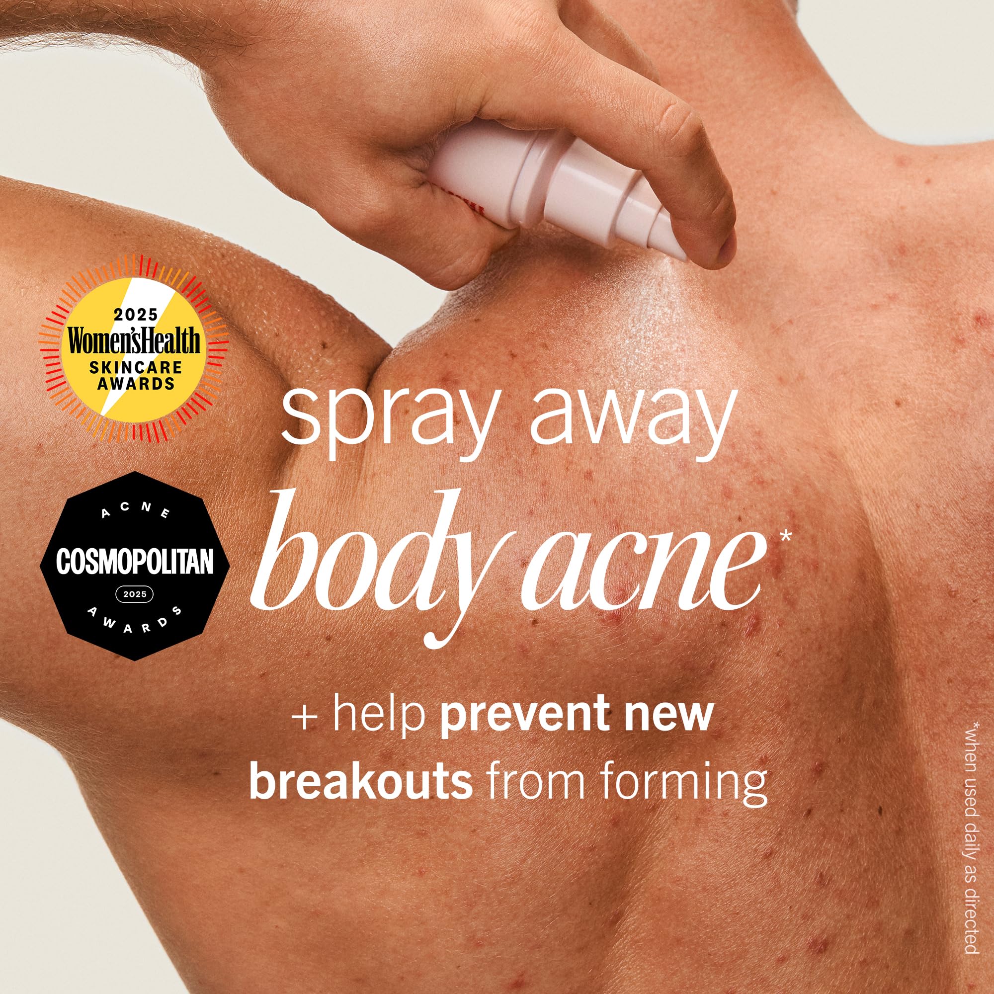 First Aid Beauty maximum strength acne treatment spray nozzle layout for easy application