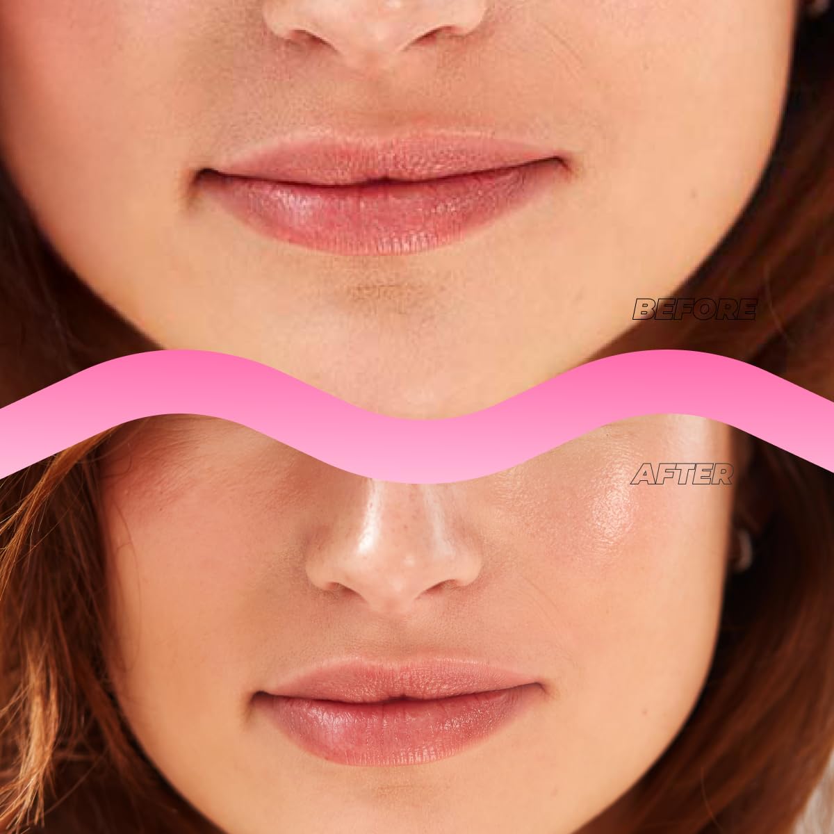 Vitamasques lip mask packaging showing micro-dart technology
