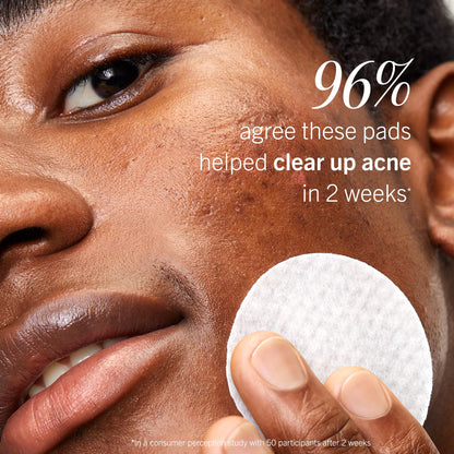First Aid Beauty imported USA skincare acne treatment pads