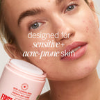 Complete First Aid Beauty acne treatment jar with box packaging
