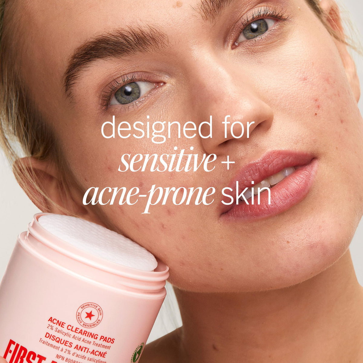 Complete First Aid Beauty acne treatment jar with box packaging