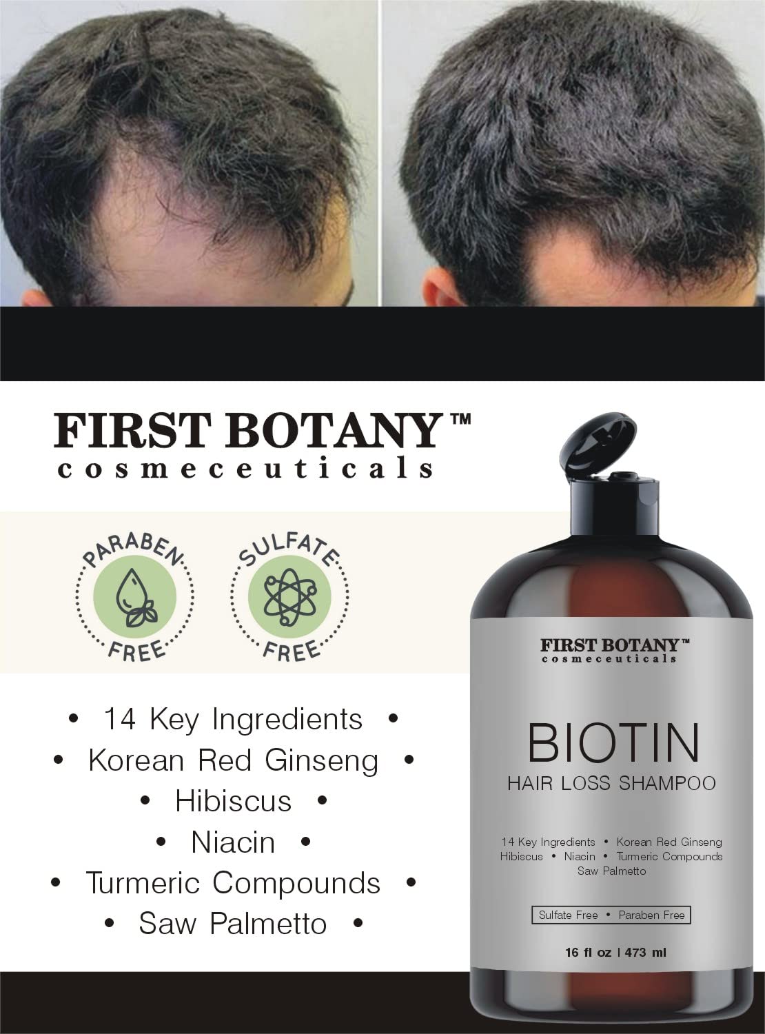 First Botany hair loss shampoo bottle side view highlighting daily hydrating and volumizing benefits