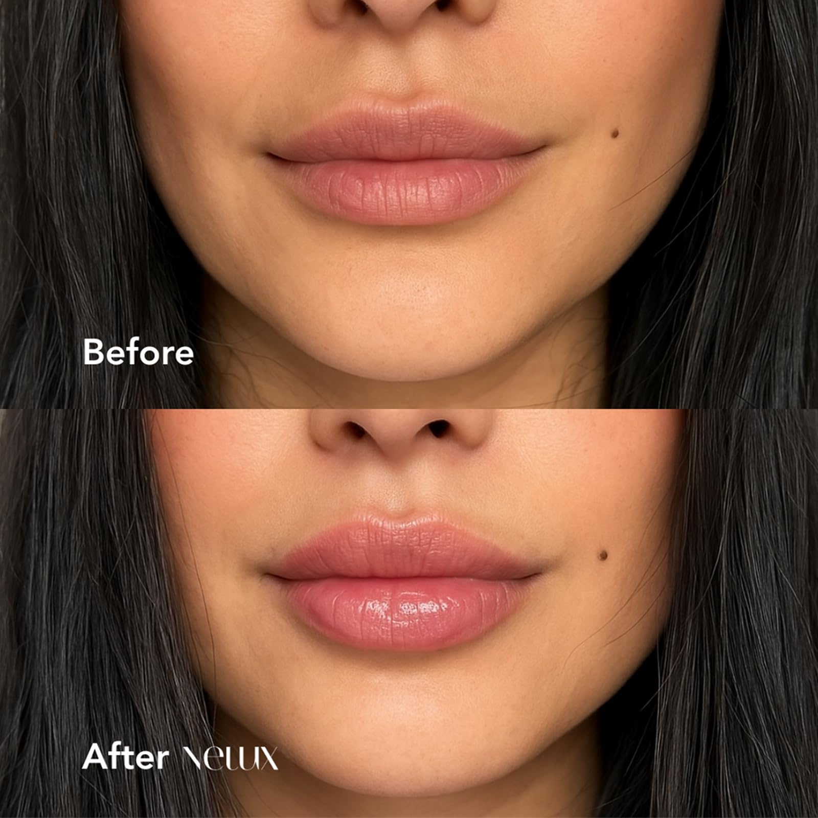 Nelux lip plumper rectangular packaging front view