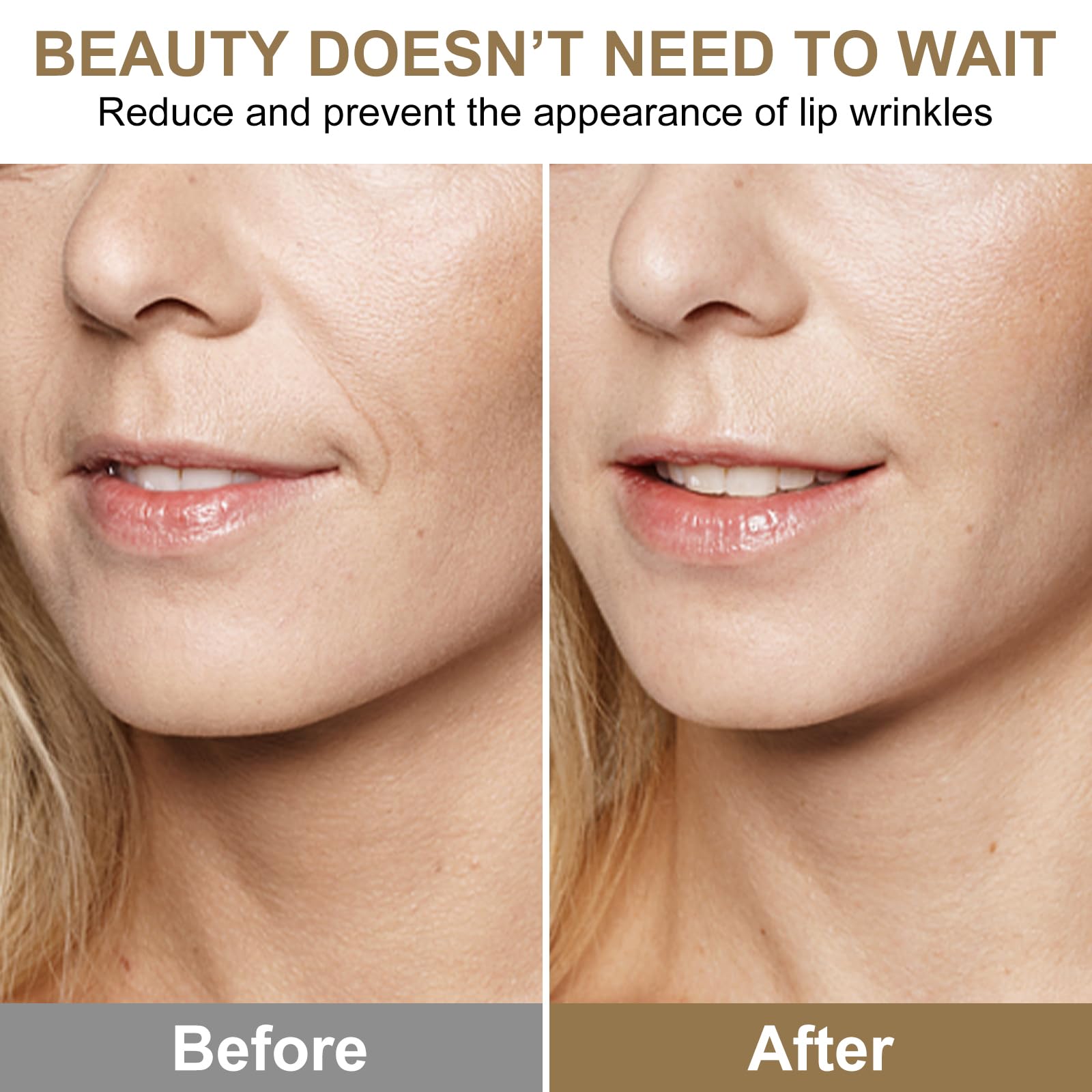 Transparent overnight smoothing pads for mouth lines