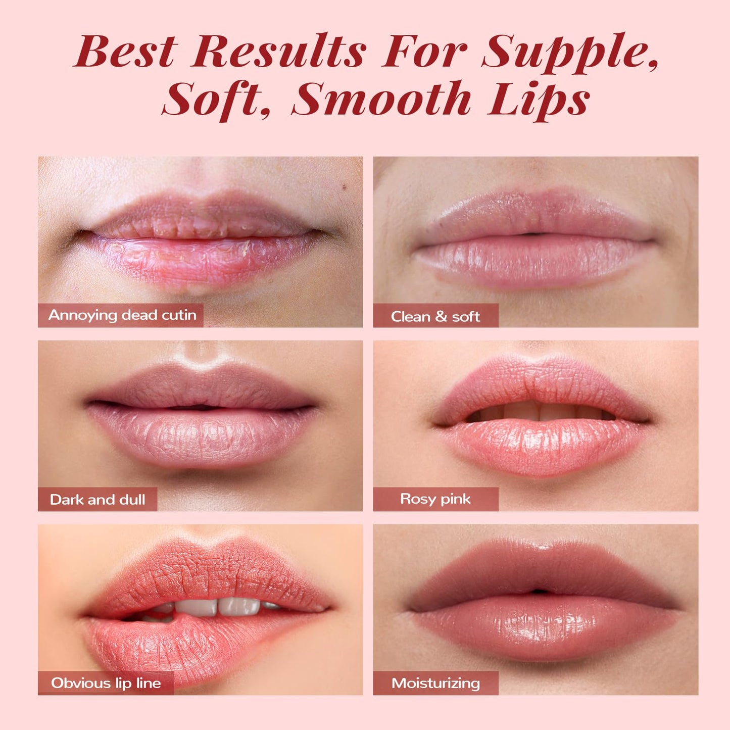 Anairui lip care set ingredients and packaging
