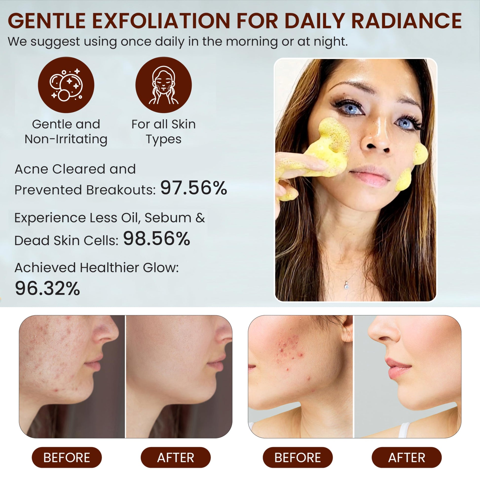 Benefits of Live Healthy turmeric face wash for acne and blackheads