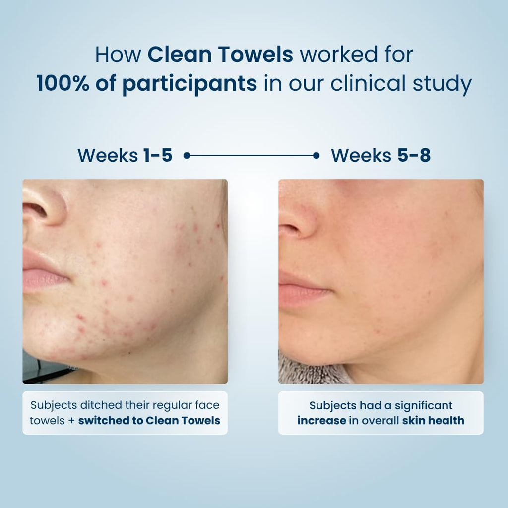 Open box of Clean Skin Club clean towels revealing individual dry wipes