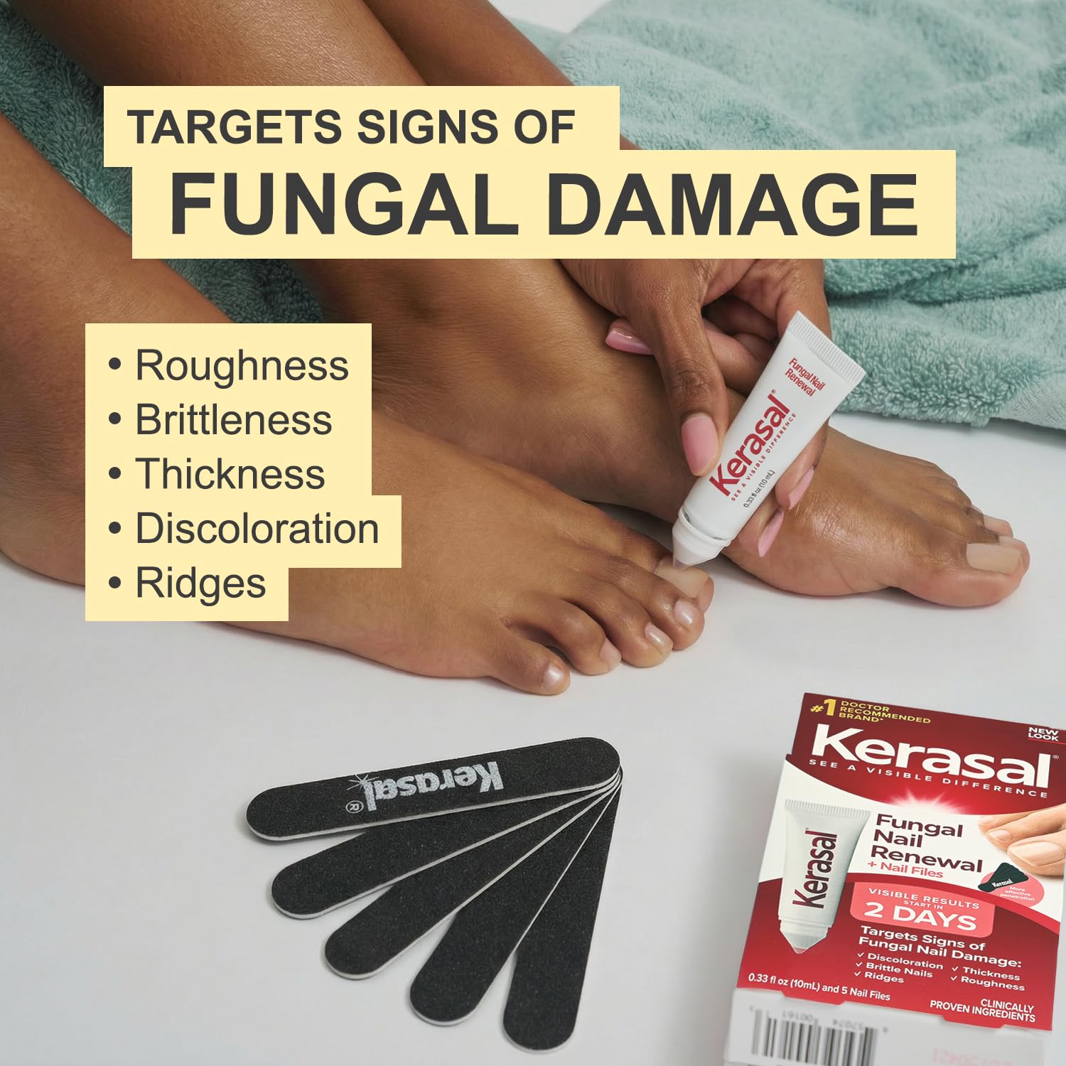 Before and after comparison showing improved nail discoloration after using Kerasal