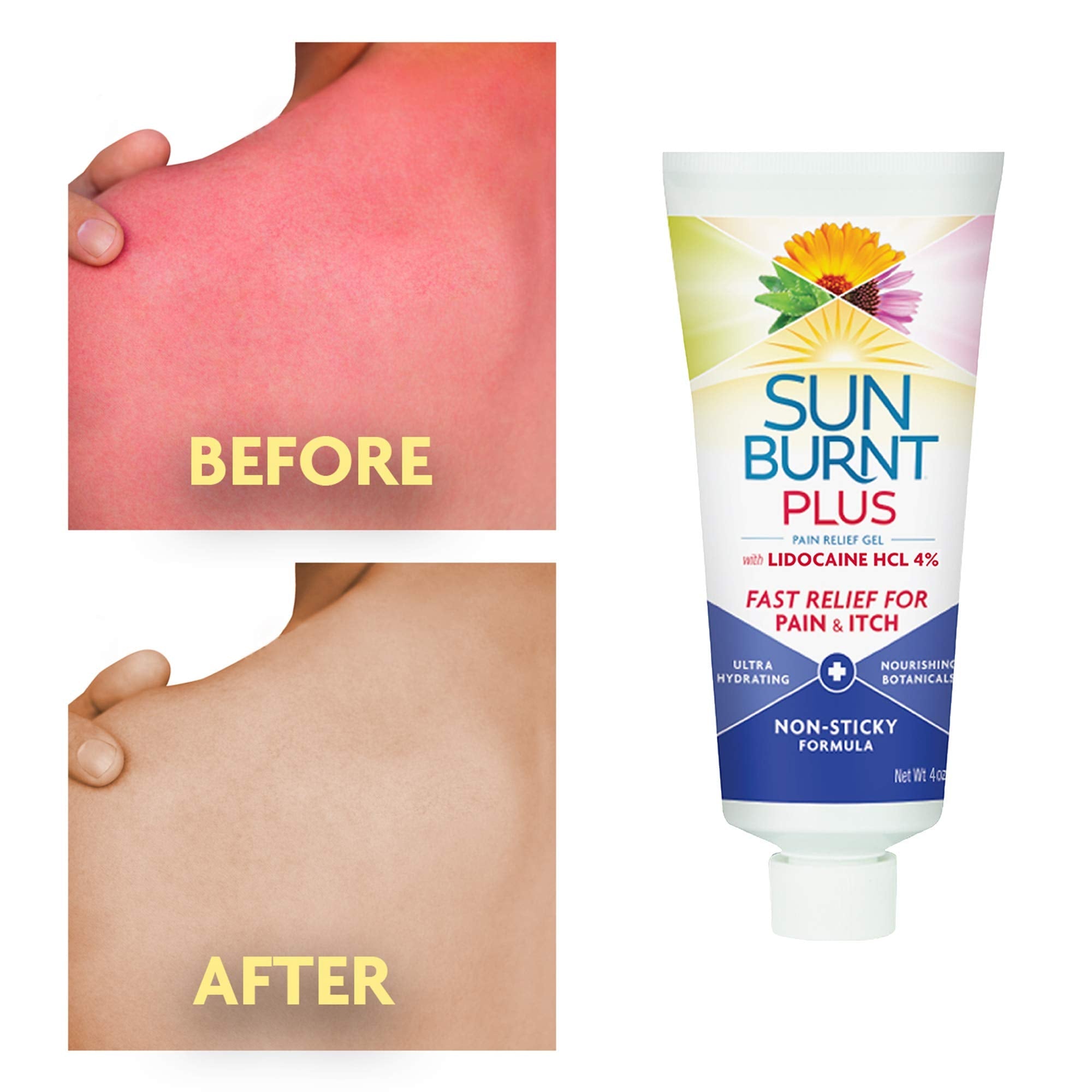 Sunburnt Plus after sun treatment ingredients label detail