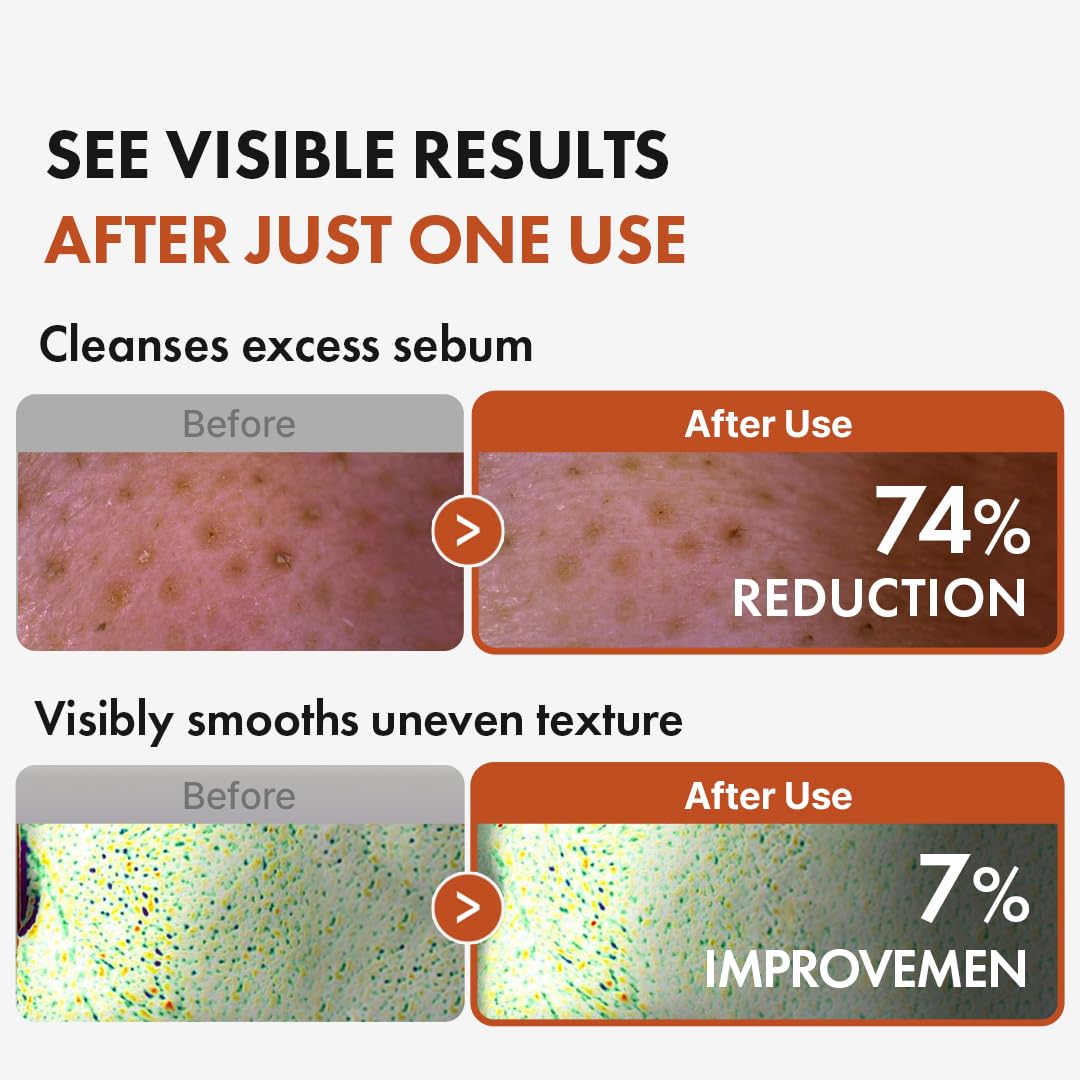 Authentic Hanskin BHA Pore Cleansing Oil label details