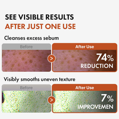 Authentic Hanskin BHA Pore Cleansing Oil label details