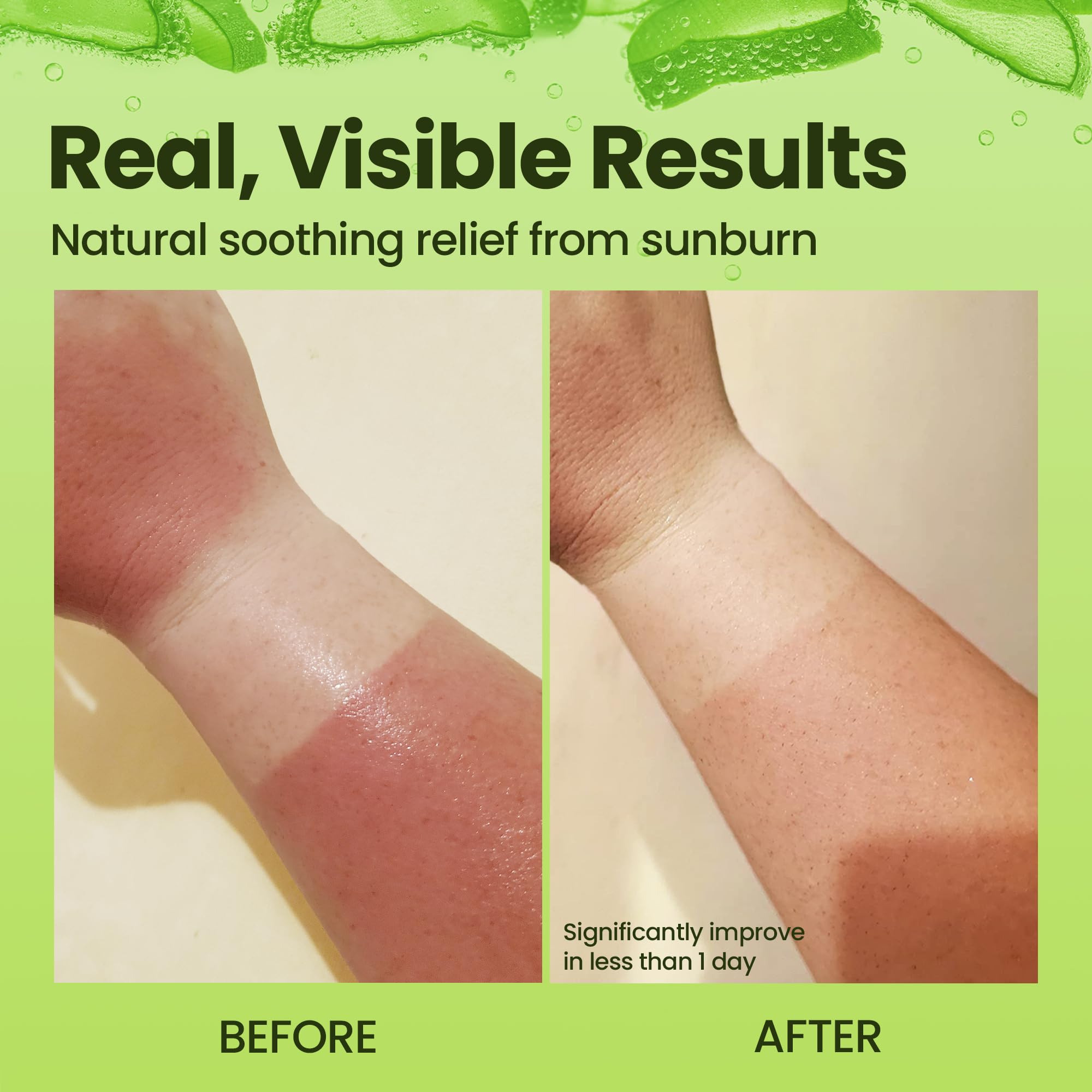 Honeyskin aloe vera gel packaging with apple stem cell highlight