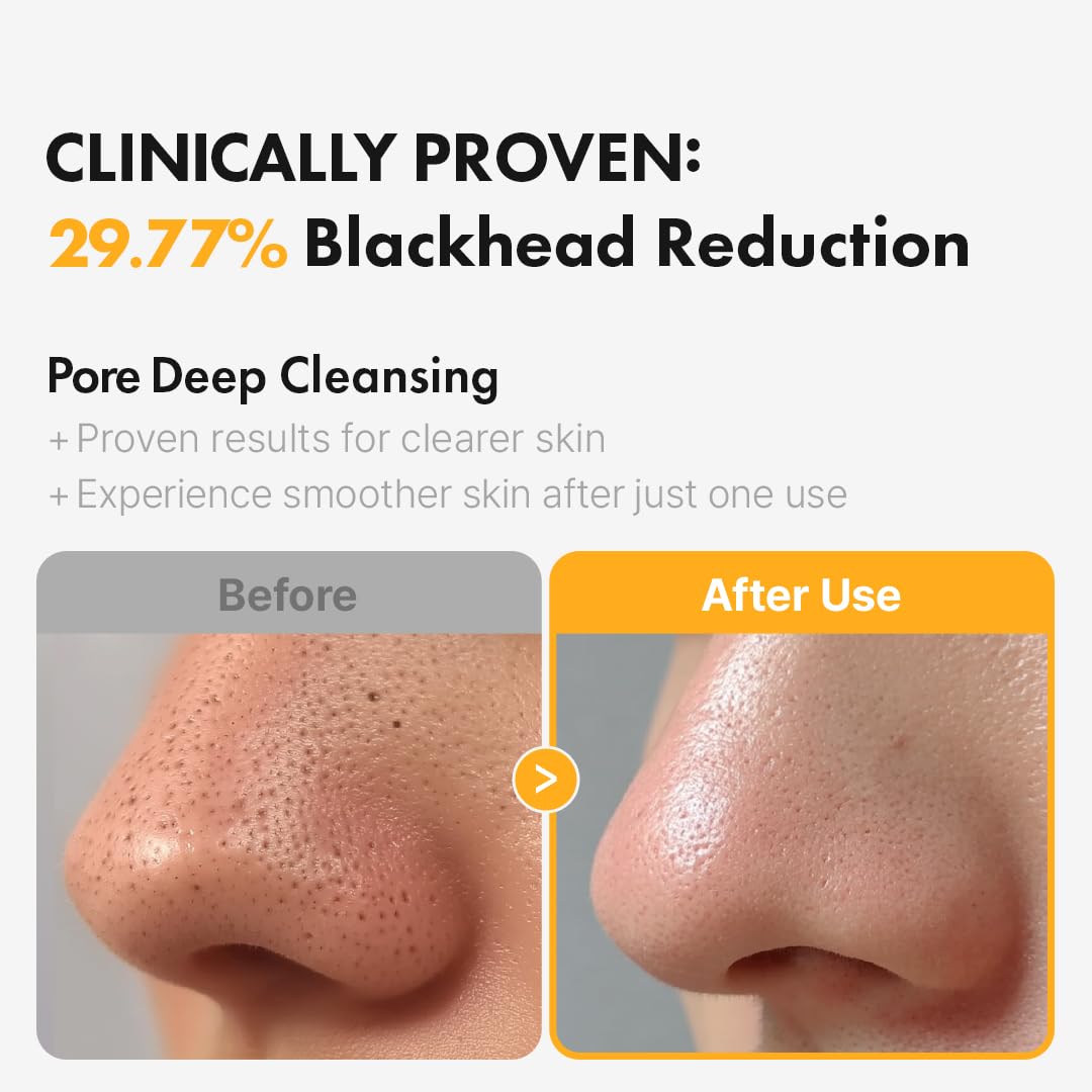 Hanskin Pore Cleansing Oil bottle showing PHA label