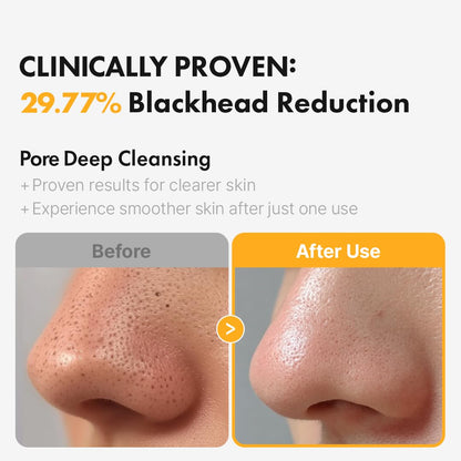Hanskin Pore Cleansing Oil bottle showing PHA label