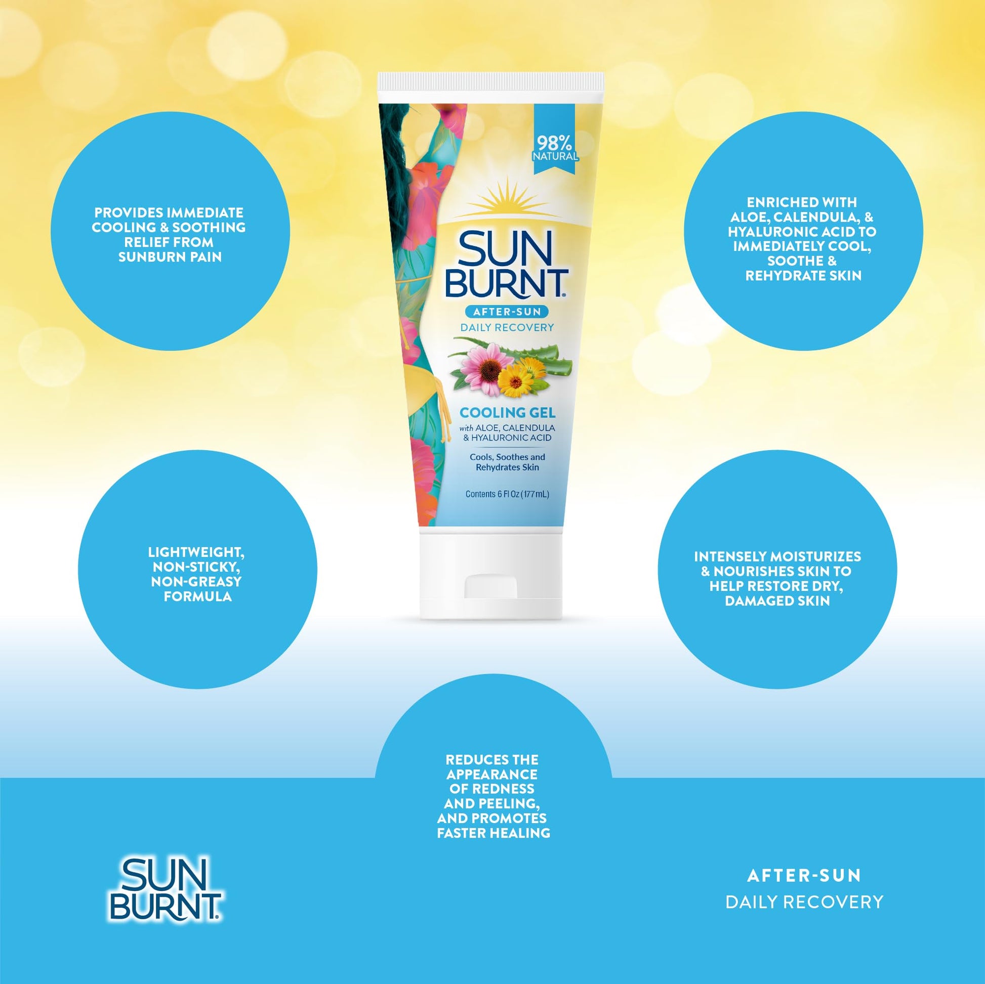 Sunburnt aloe vera gel for sunburn relief product application