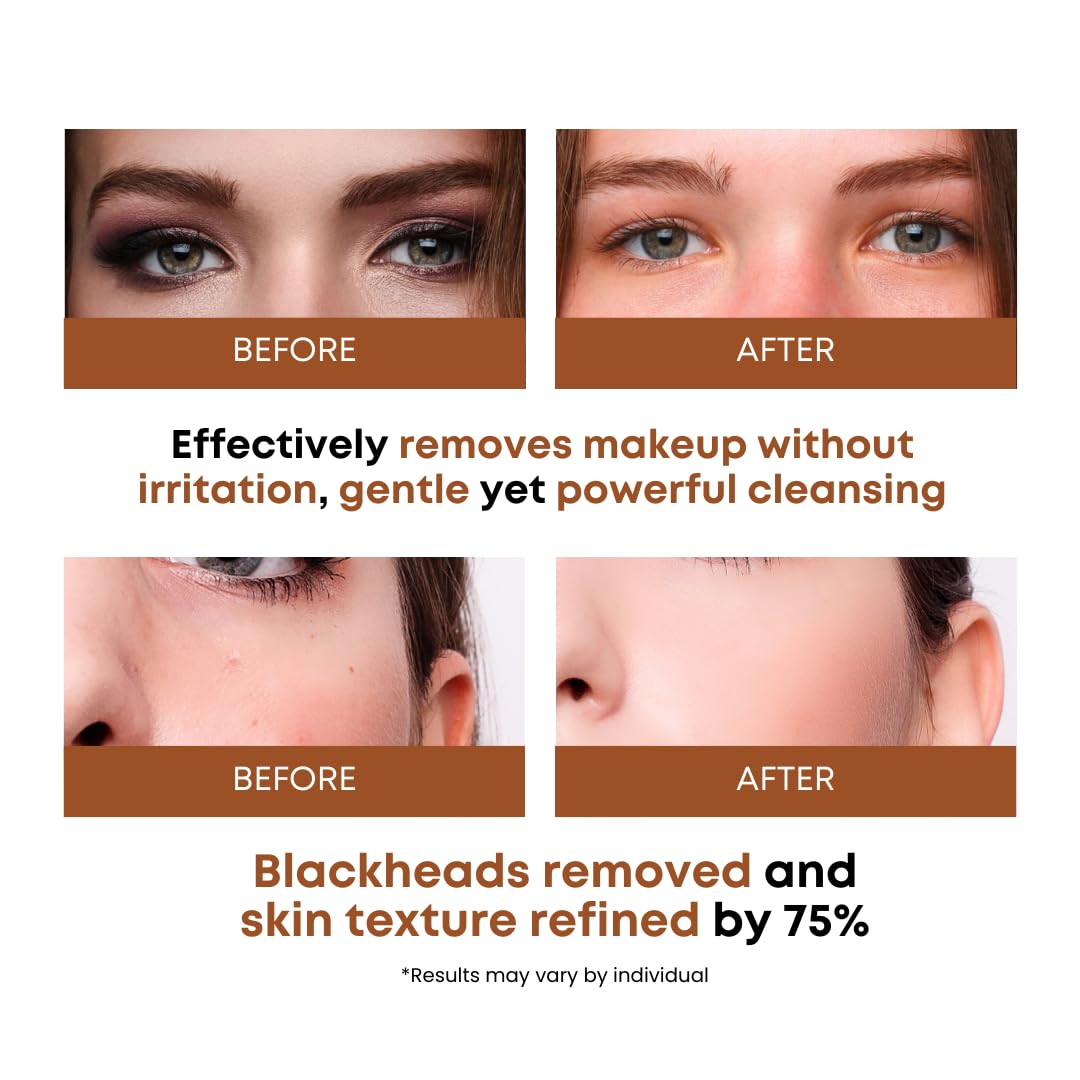 Somisome rice water skincare product label details