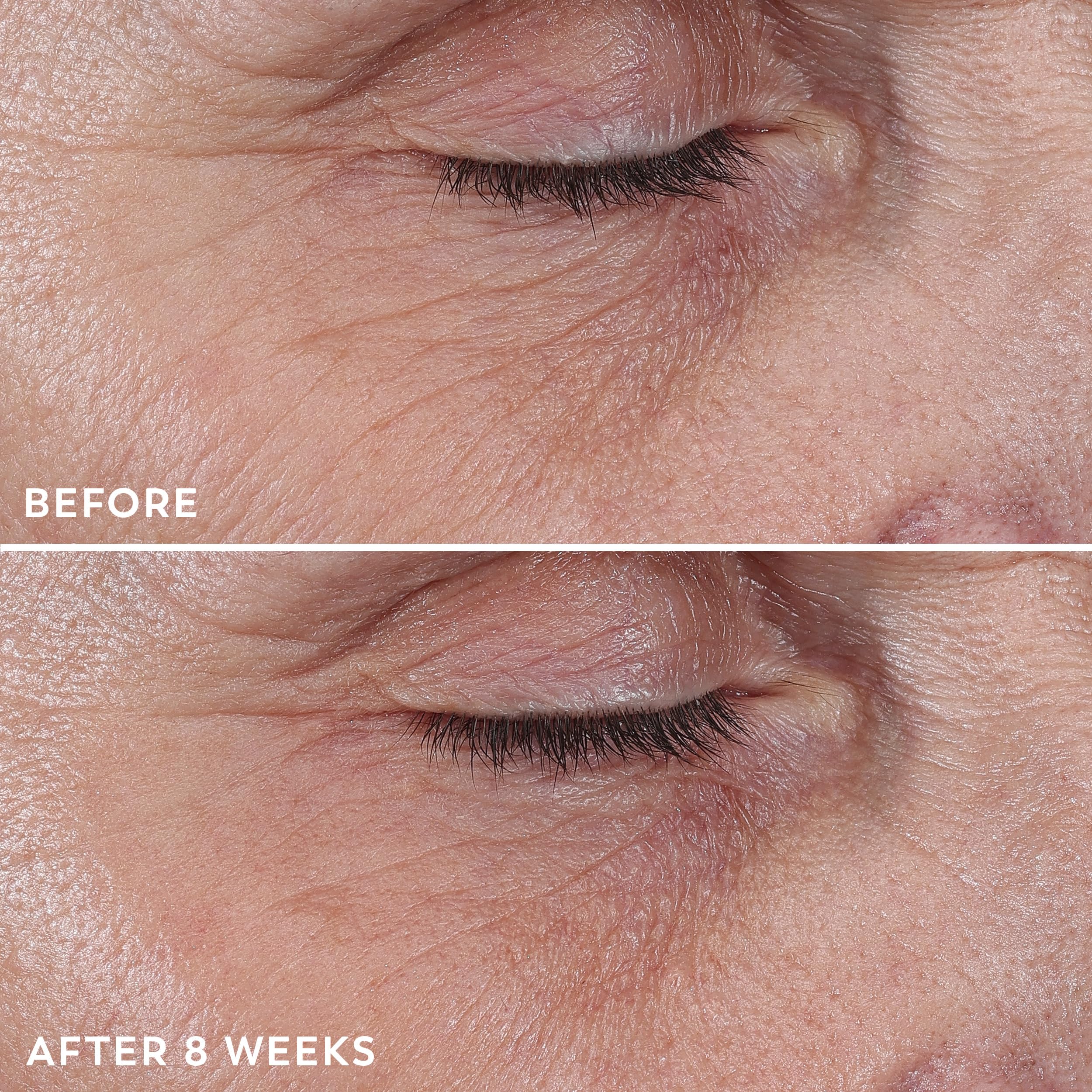 Olay under eye bags treatment cream box side details
