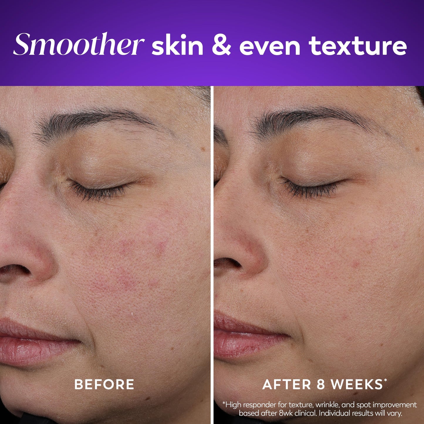 Olay Retinol Night Cream for women with Vitamin B3 and Peptide matrix graphics