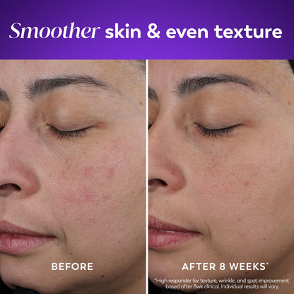 Olay Retinol Night Cream for women with Vitamin B3 and Peptide matrix graphics