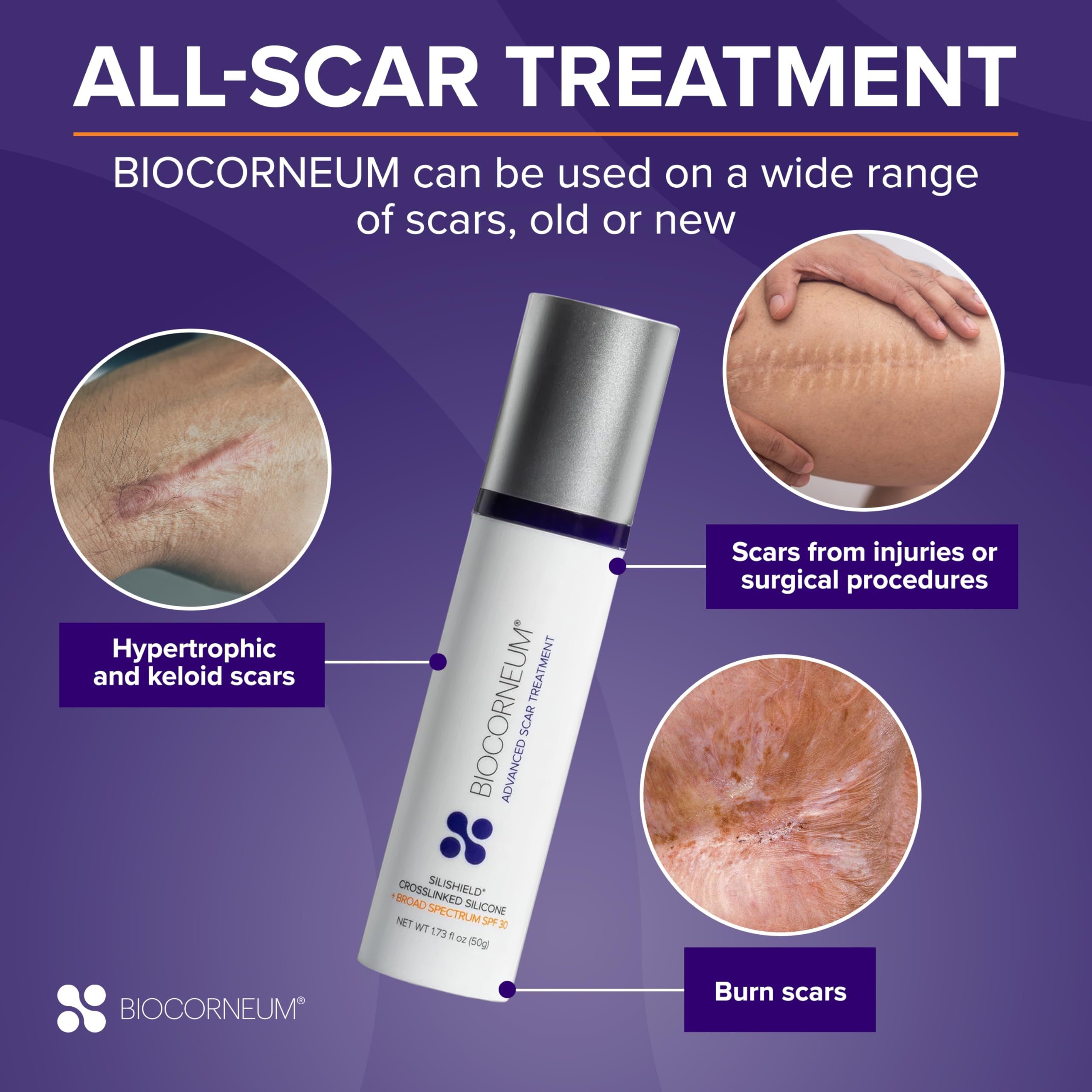 Surgeon recommended medical grade silicone scar treatment 10g