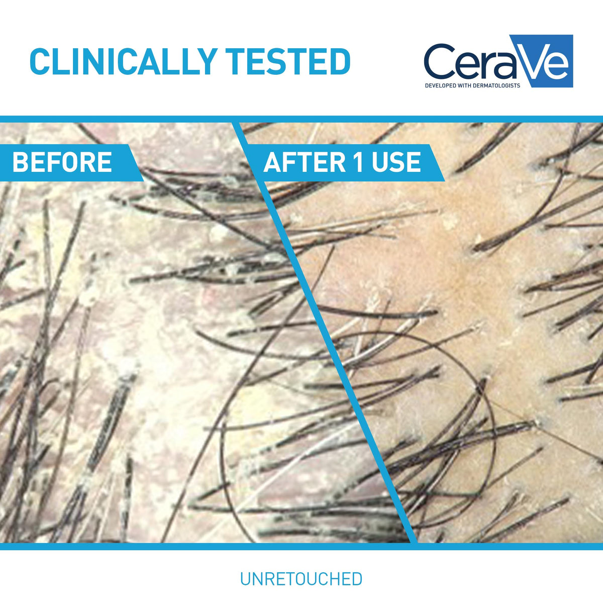 CeraVe Hydrating Anti Dandruff Shampoo ingredient highlights label