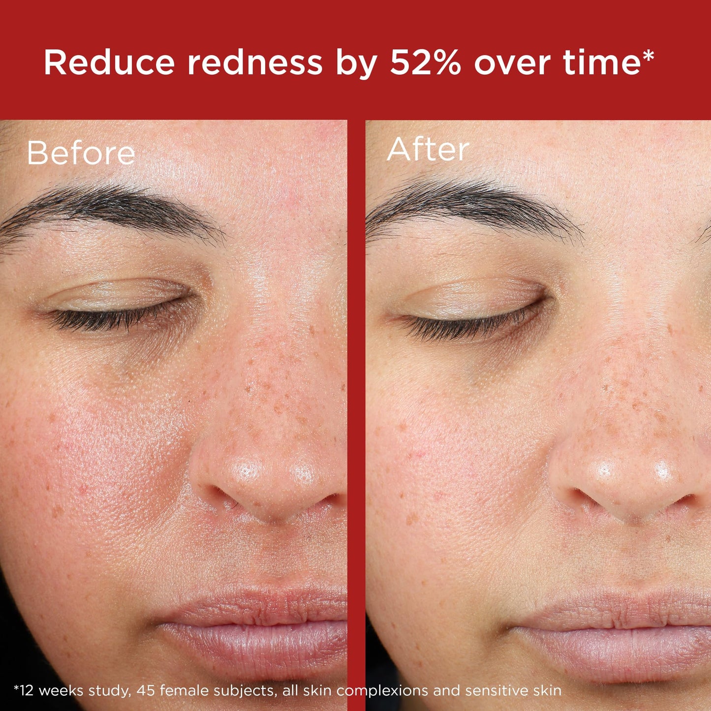 EltaMD UV Skin Recovery broad spectrum SPF 50 back label showing active ingredients