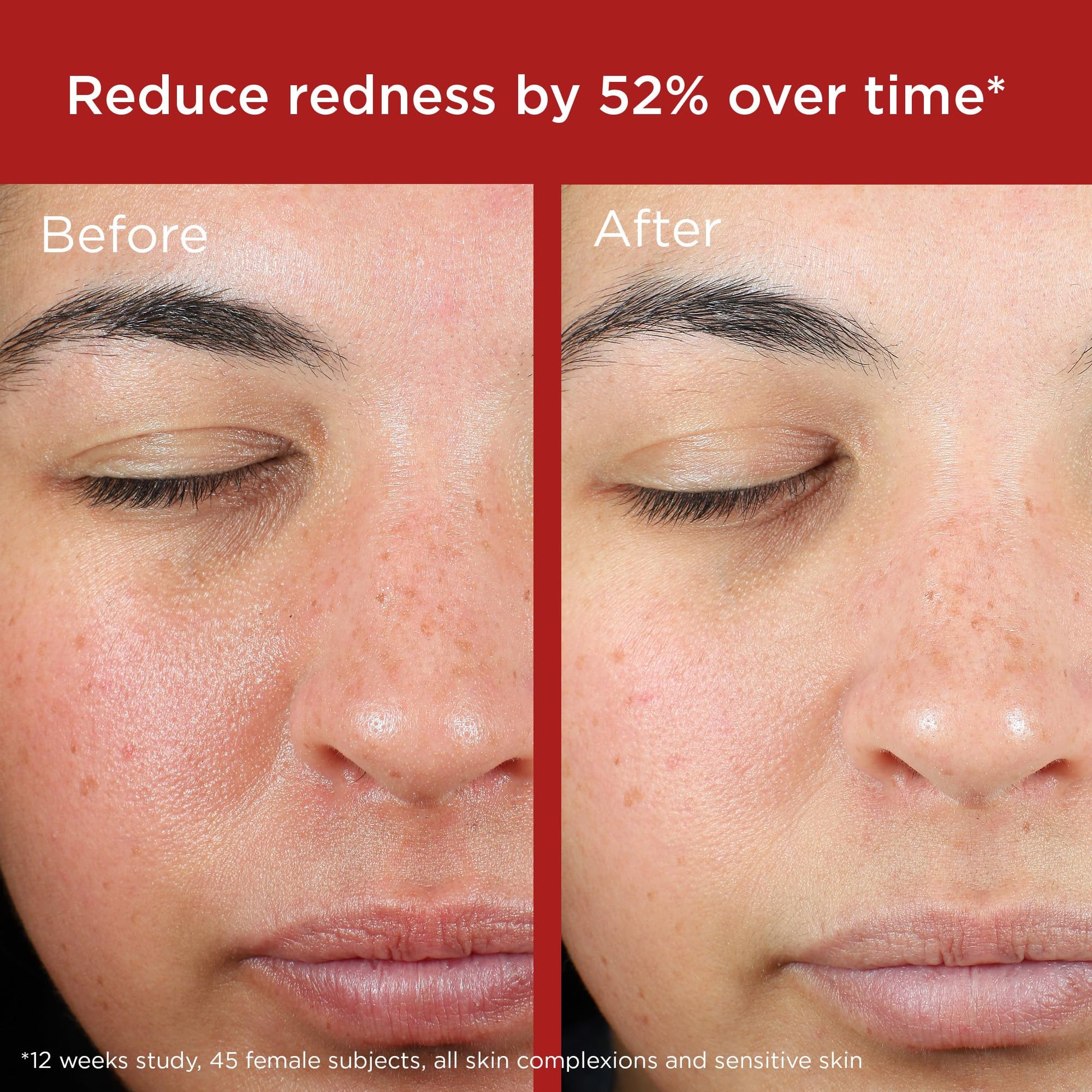 EltaMD UV Skin Recovery broad spectrum SPF 50 back label showing active ingredients