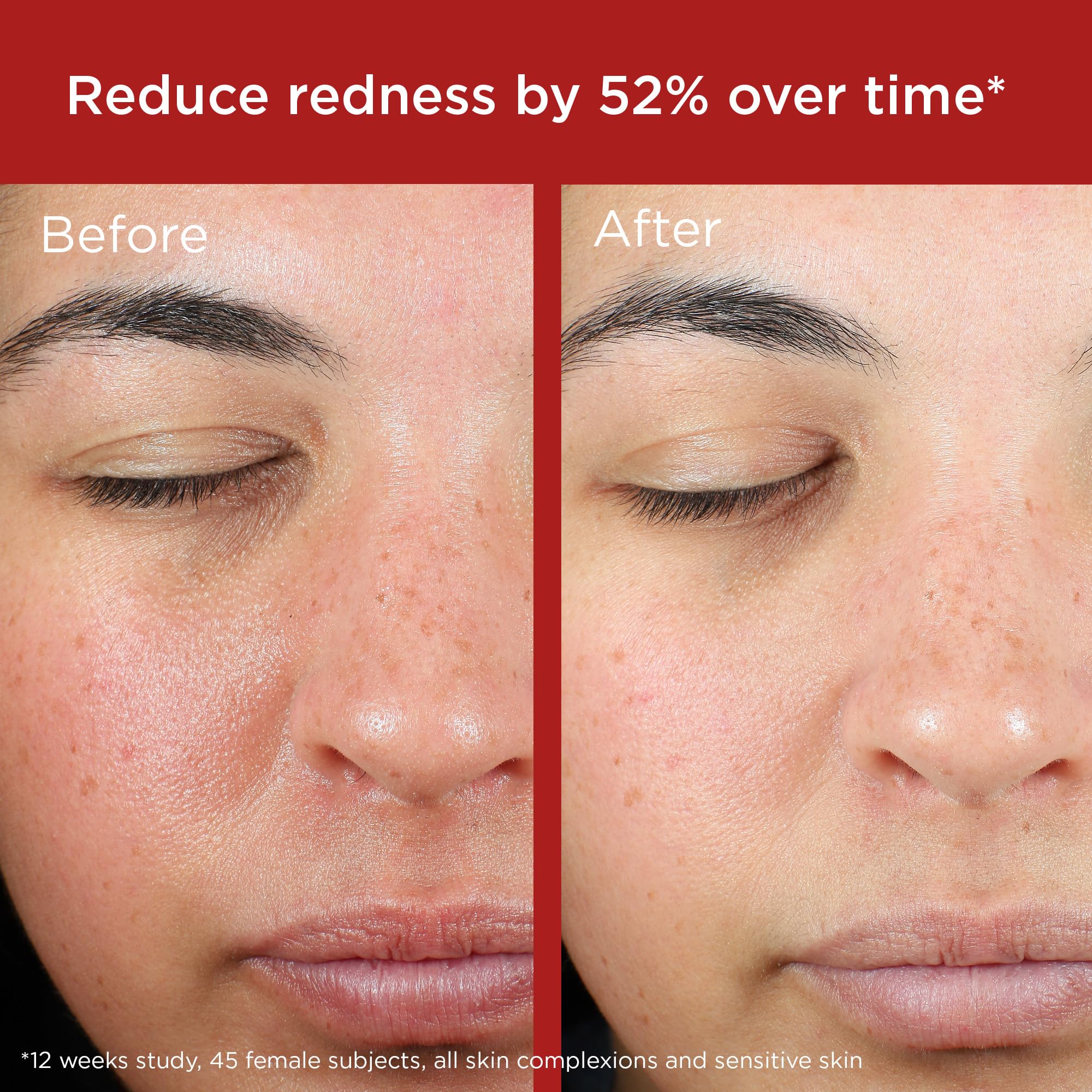 EltaMD UV Skin Recovery broad spectrum SPF 50 back label showing active ingredients