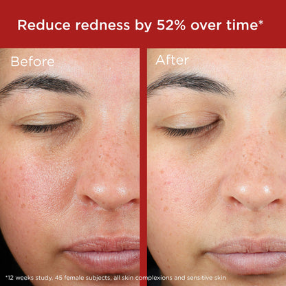 EltaMD UV Skin Recovery broad spectrum SPF 50 back label showing active ingredients