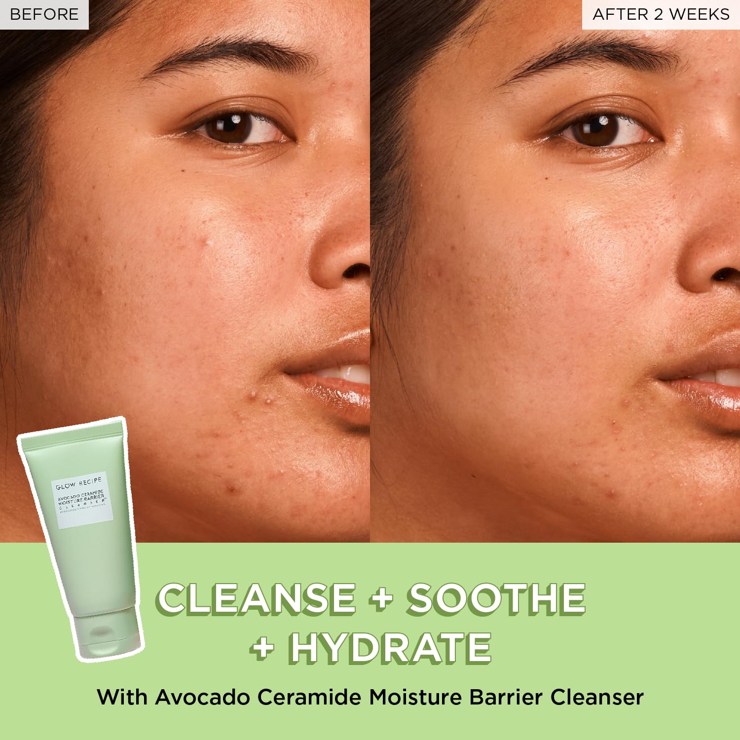 Watermelon Glow Niacinamide Dew Drops mini bottle from the Fruit Babies collection.