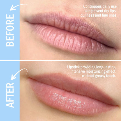 Kyda SPF 15 lip balm sticks set packaging