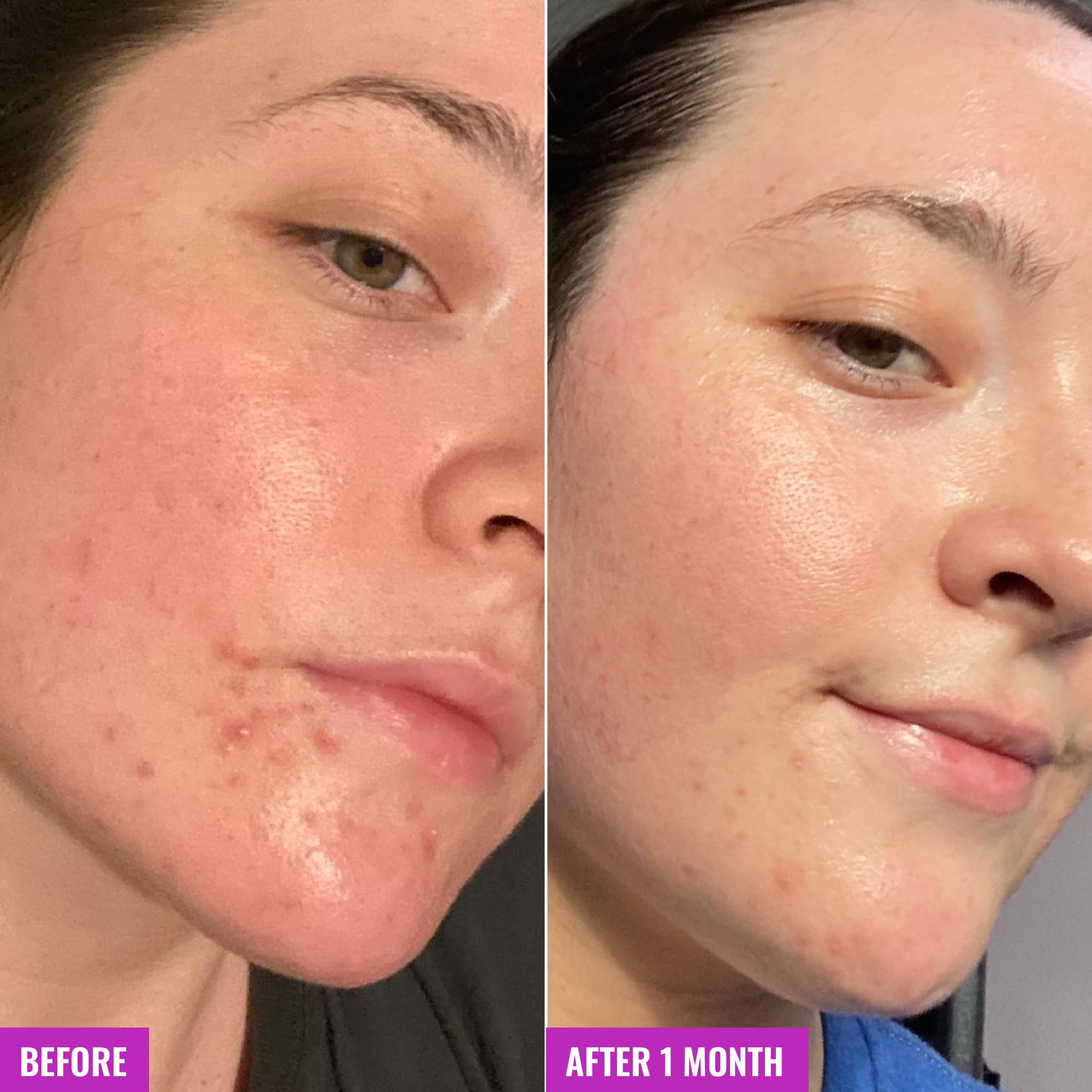 Good Molecules kaolin clay and tea tree oil skin detoxifying bar