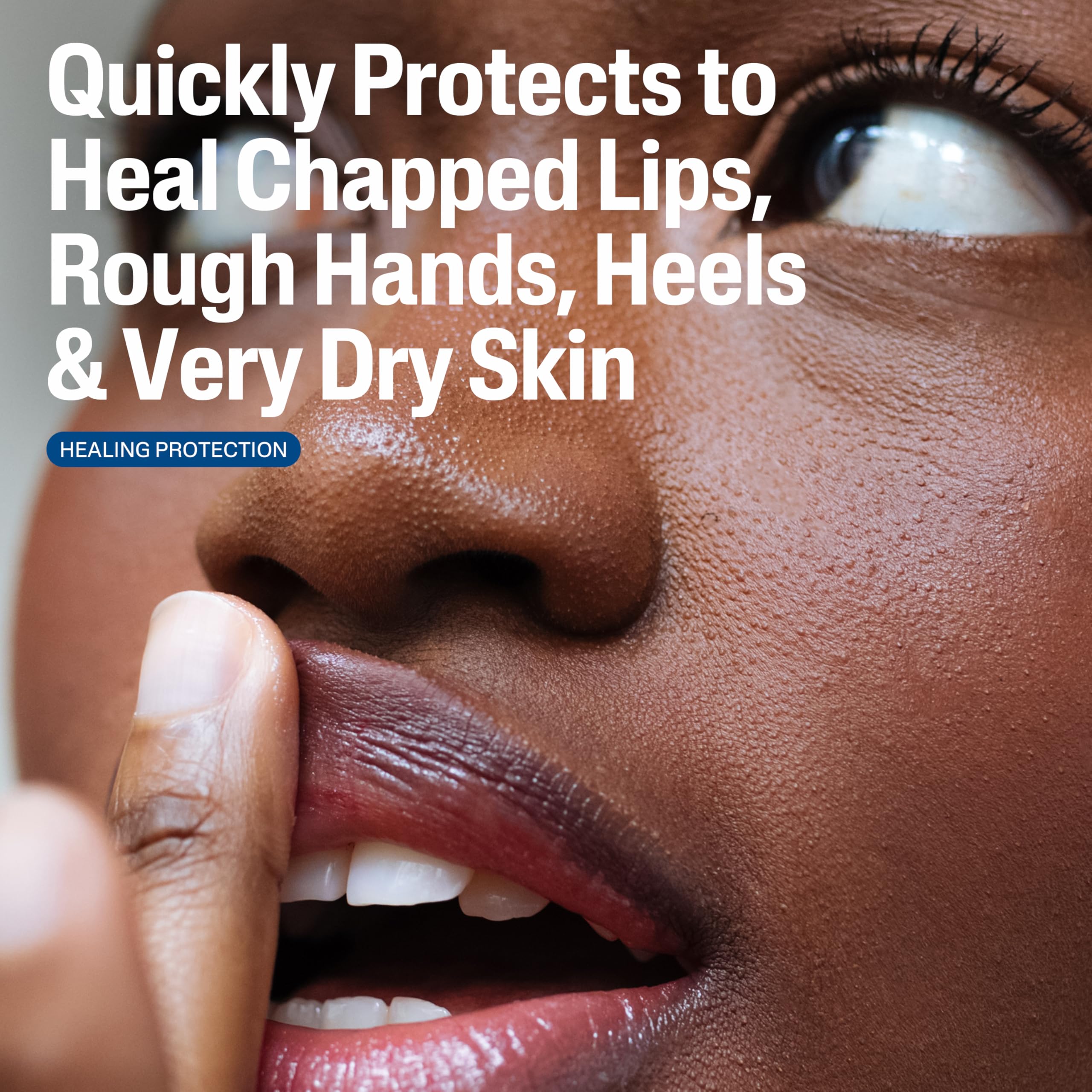 Cetaphil skin protectant ointment for dry chapped and irritated skin