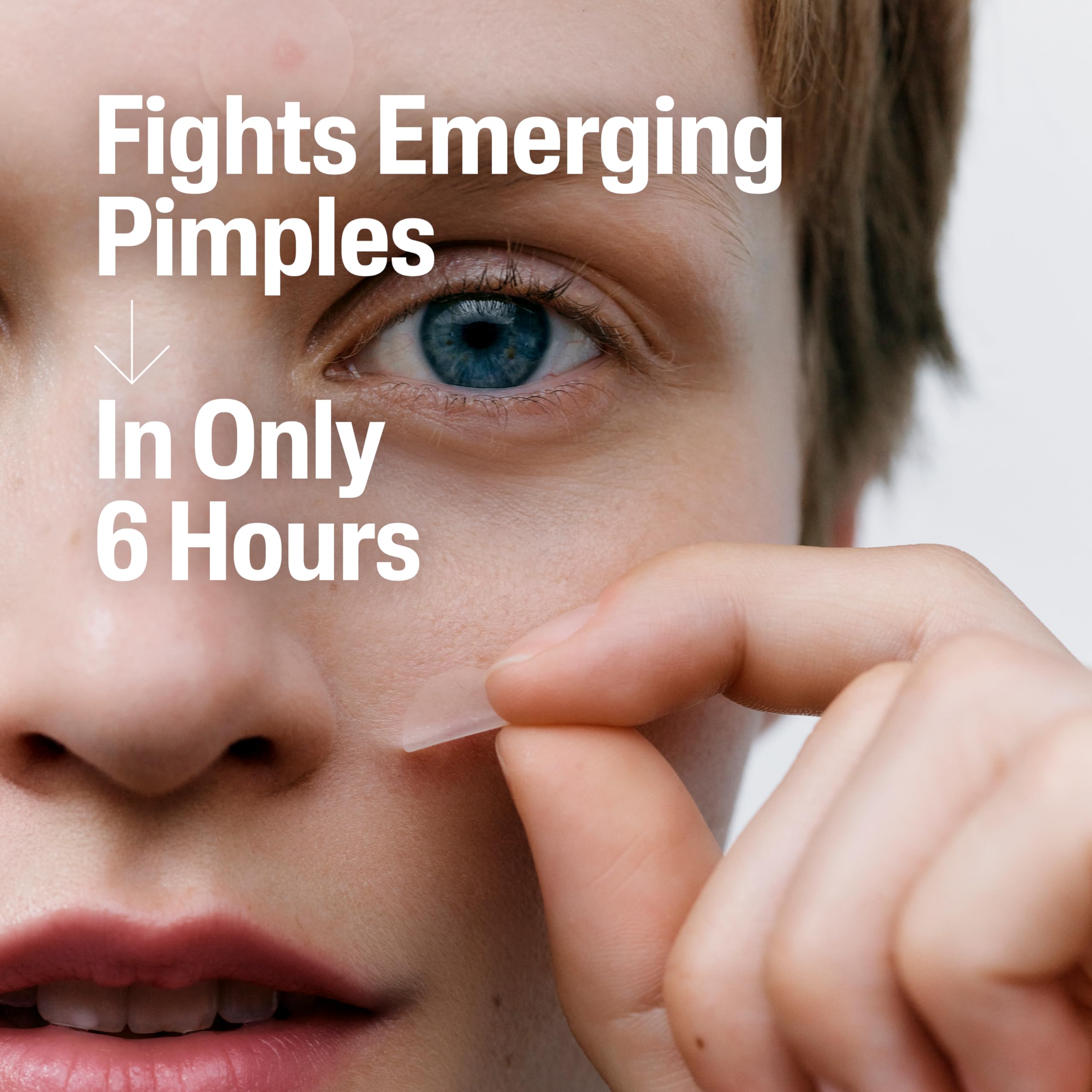 Cetaphil acne patch packaging emphasizing six hour visible results for early stage blemishes
