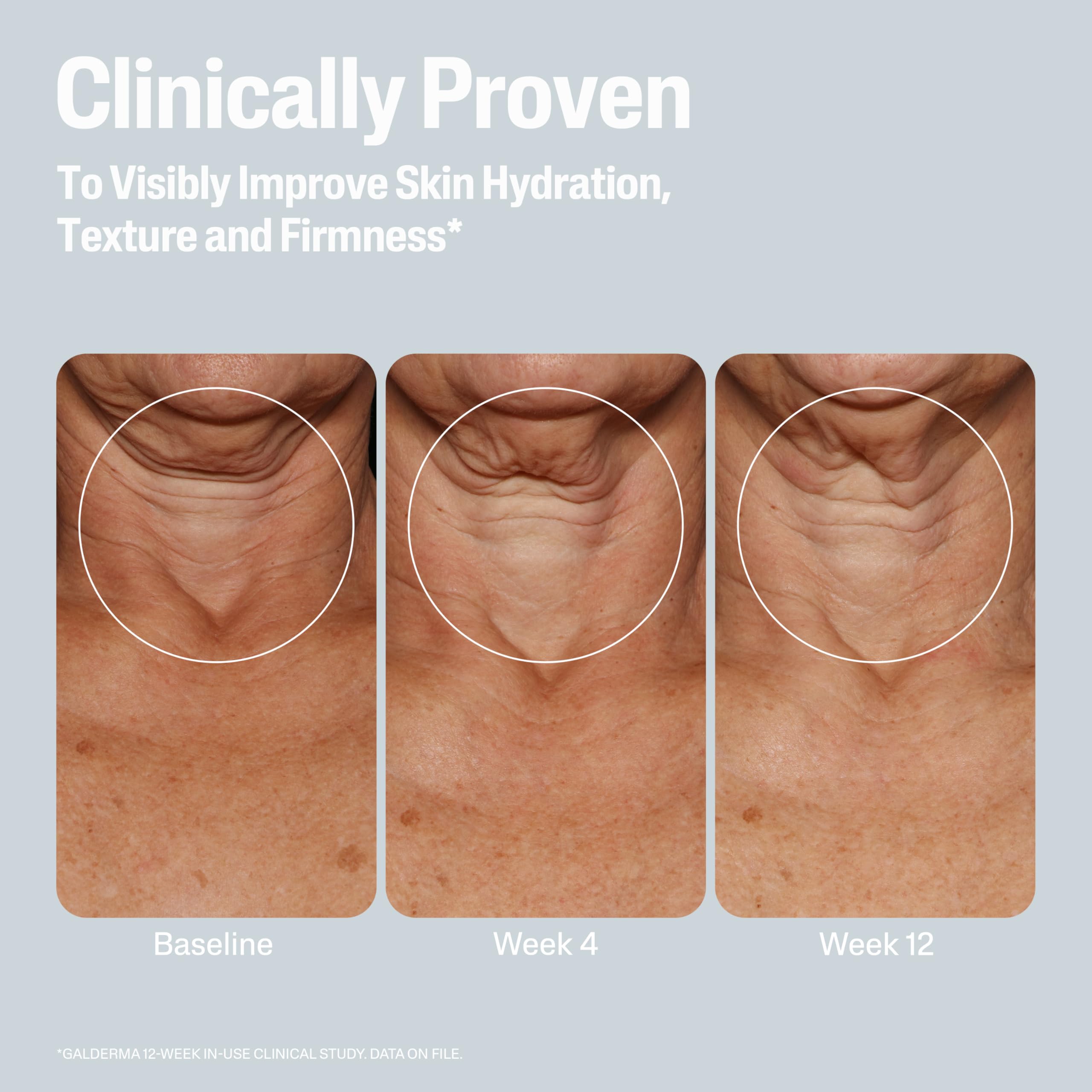 Dermatologist recommended Cetaphil body cream for sensitive and crepey skin texture repair