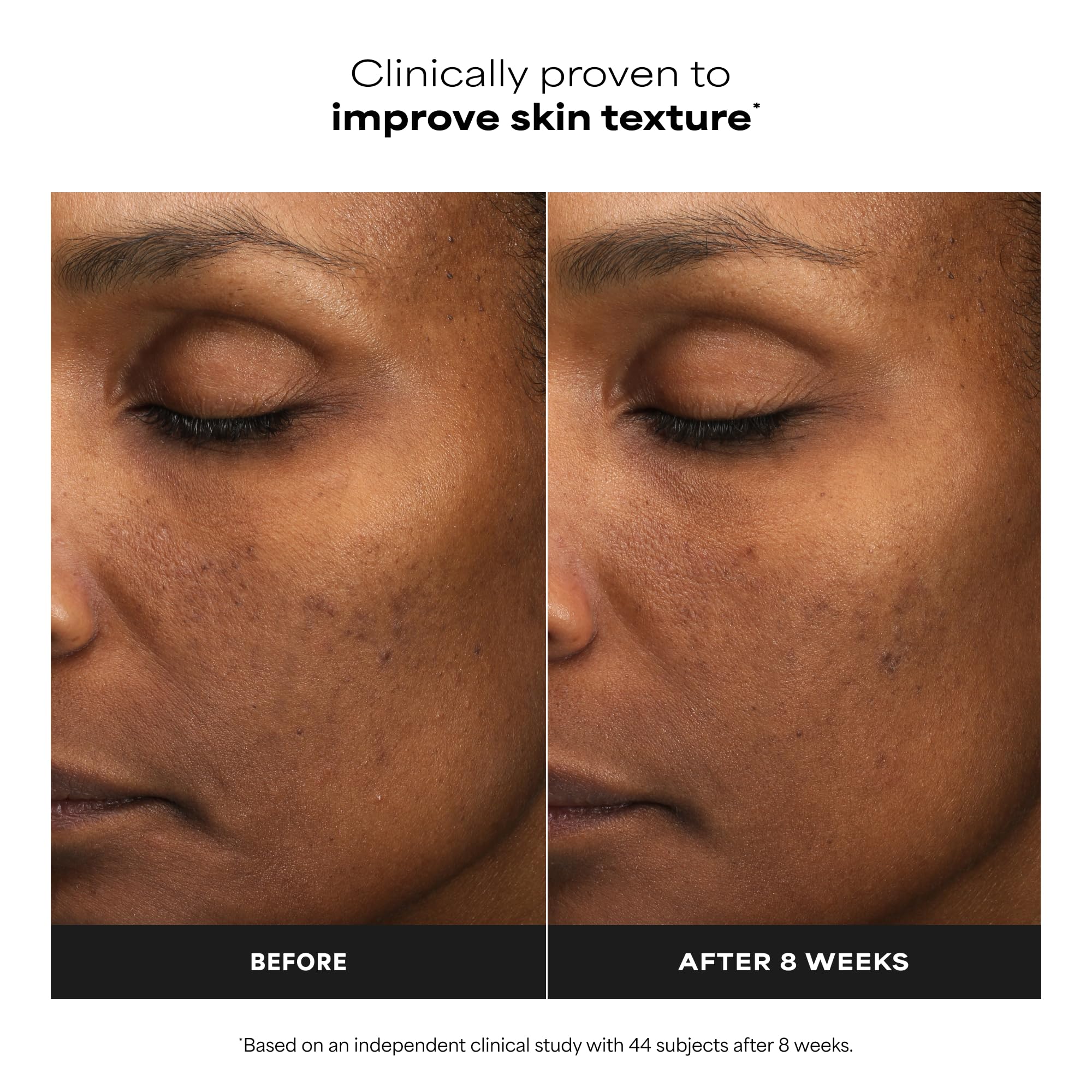 Authentic USA imported Paula's Choice mandelic acid leave on treatment for hyperpigmentation and bumpy texture