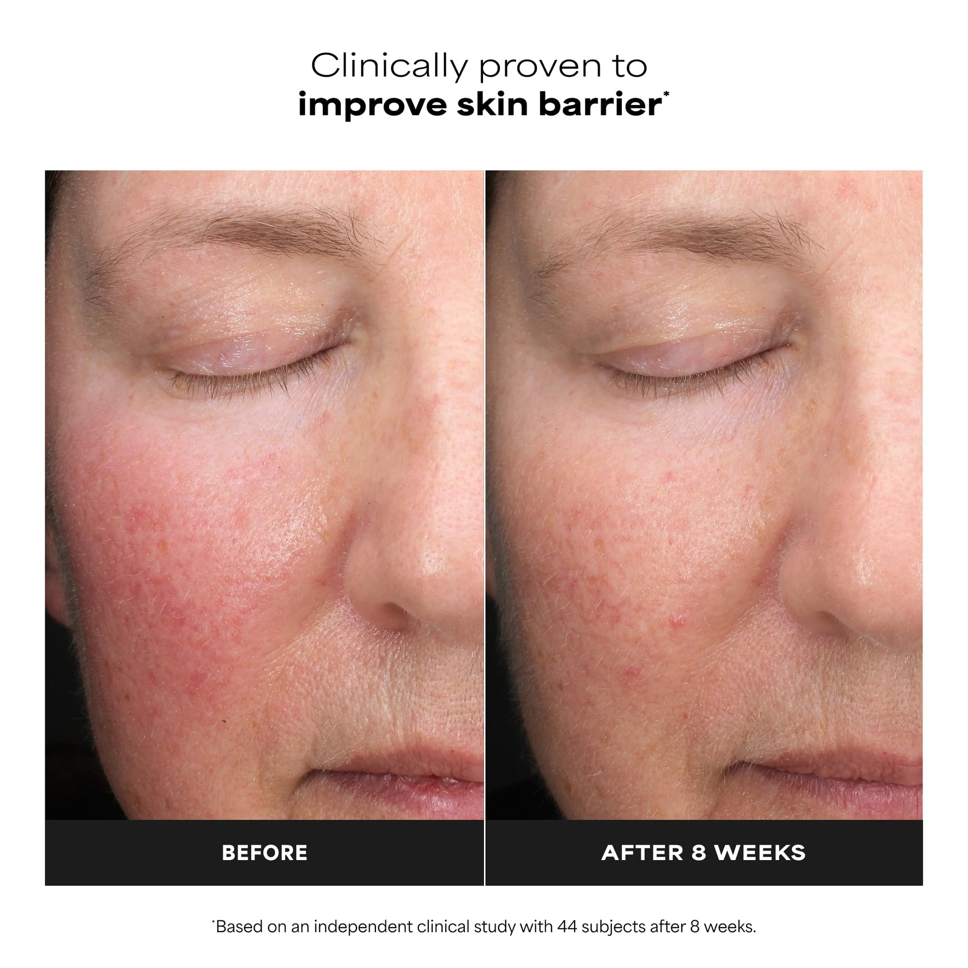 Fragrance free water light liquid exfoliant formula by Paula's Choice for correcting uneven skin tone