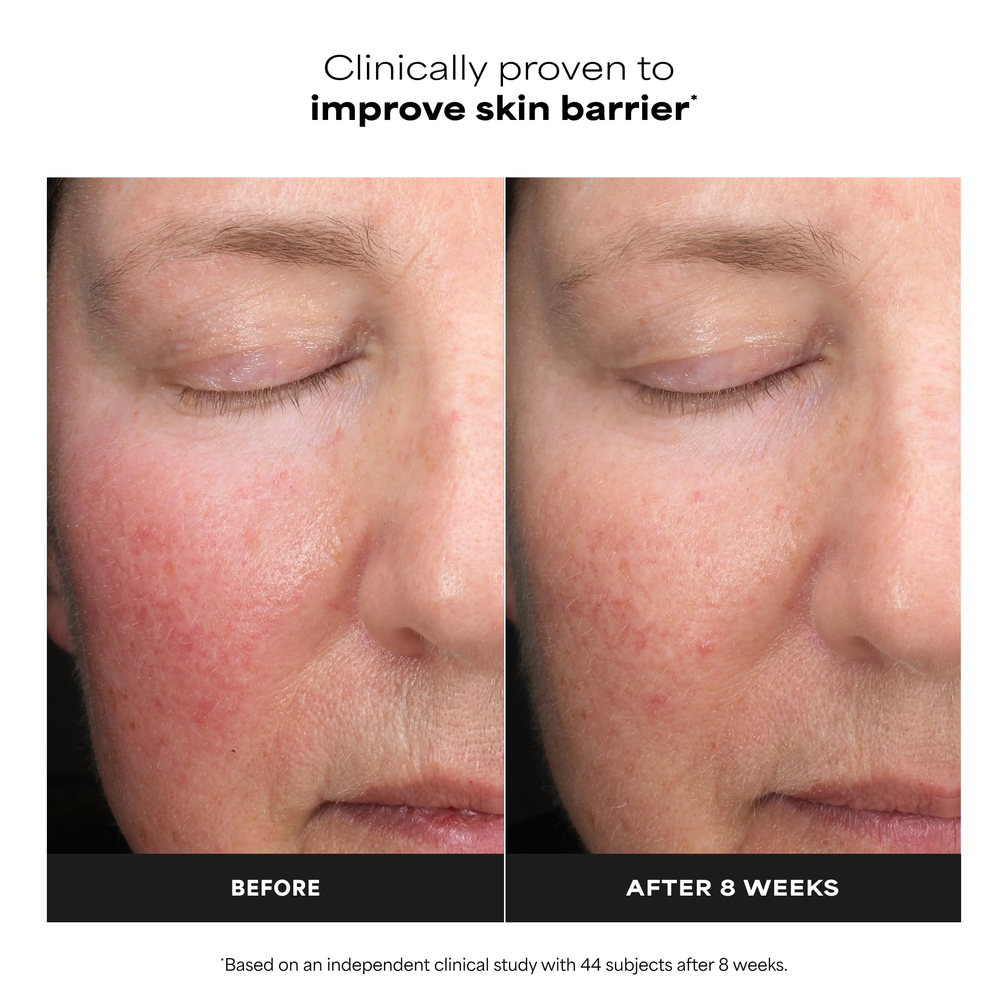 Fragrance free water light liquid exfoliant formula by Paula's Choice for correcting uneven skin tone