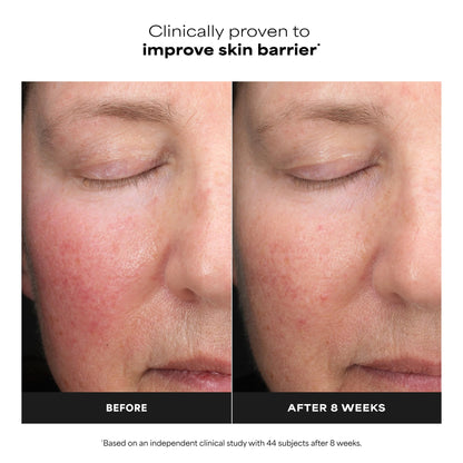 Fragrance free water light liquid exfoliant formula by Paula's Choice for correcting uneven skin tone
