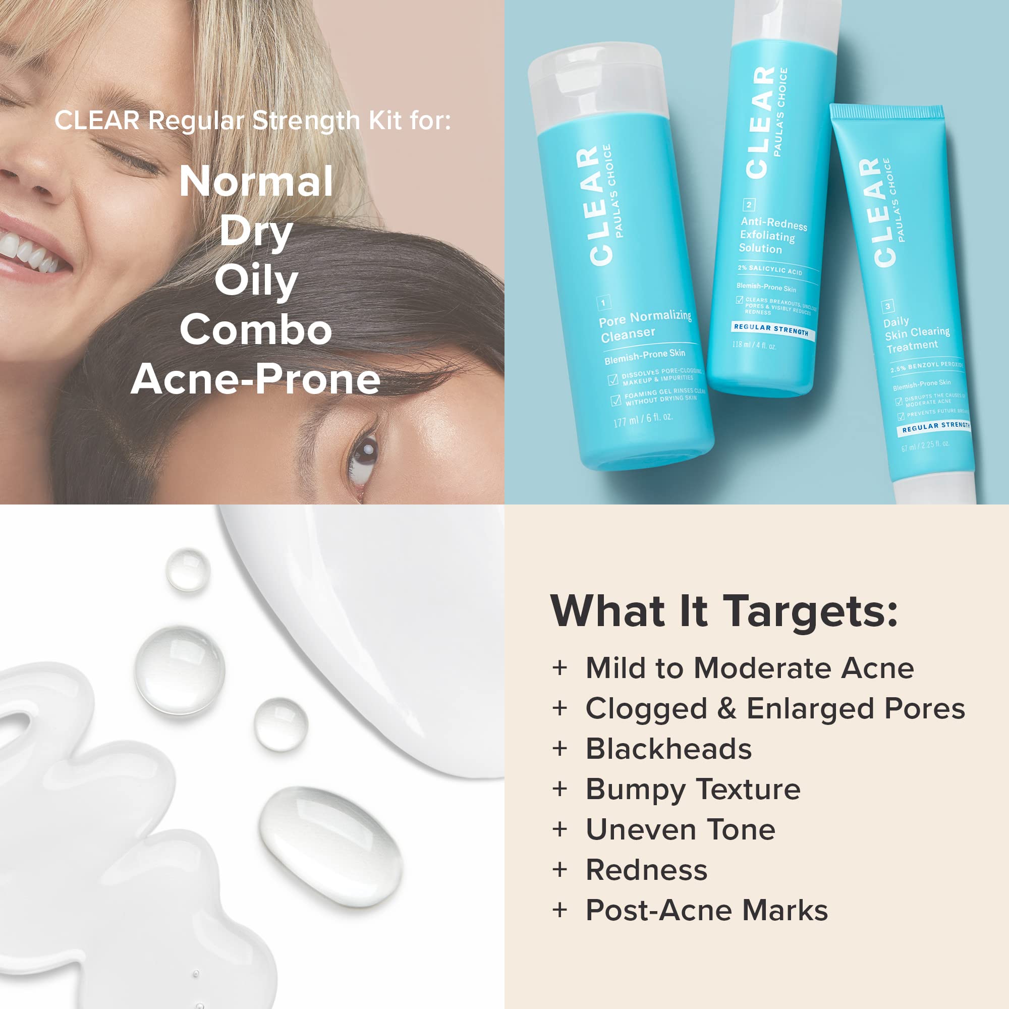 Paula's Choice CLEAR benzoyl peroxide acne skin clearing treatment tube for breakout control.