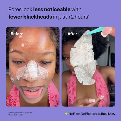 Vegan and cruelty free pore treatment patches showing universal nose shape fit