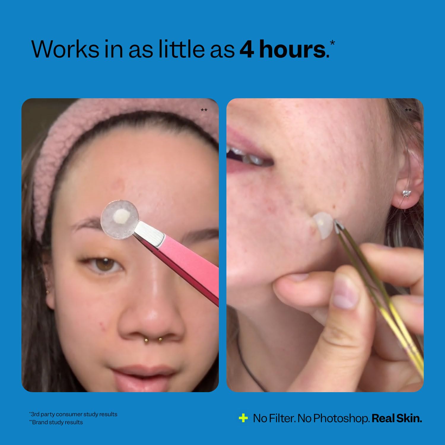 Peach Slices facial treatment spot dots applied to skin demonstrating a transparent and discreet appearance