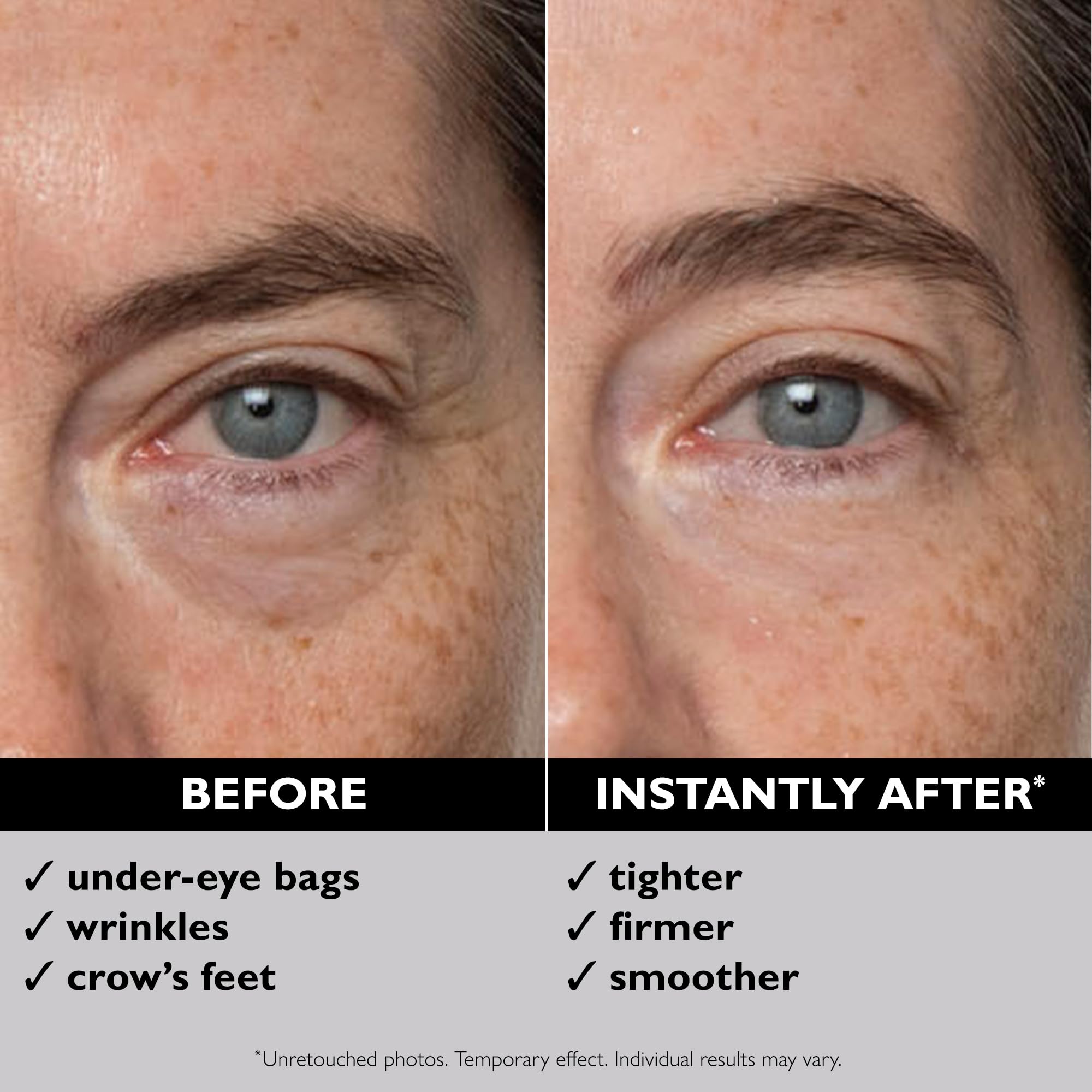 Peter Thomas Roth eye tightener box and tube