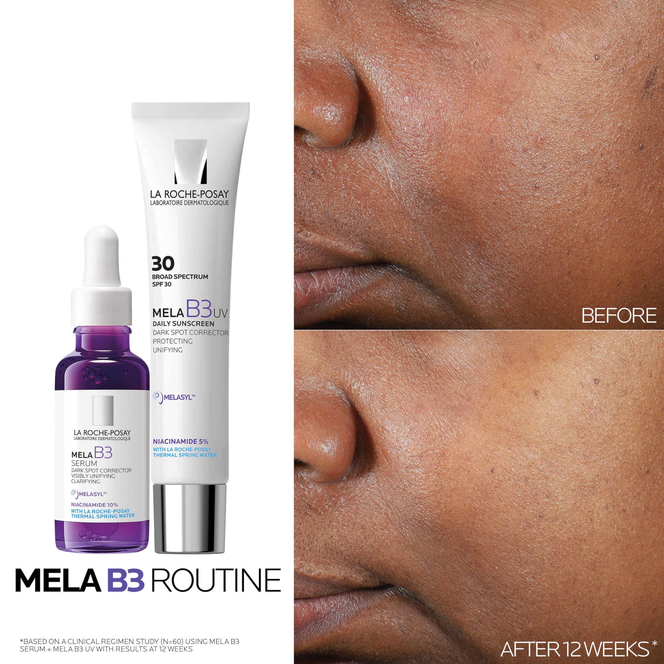 La Roche-Posay Mela B3 packaging details and branding