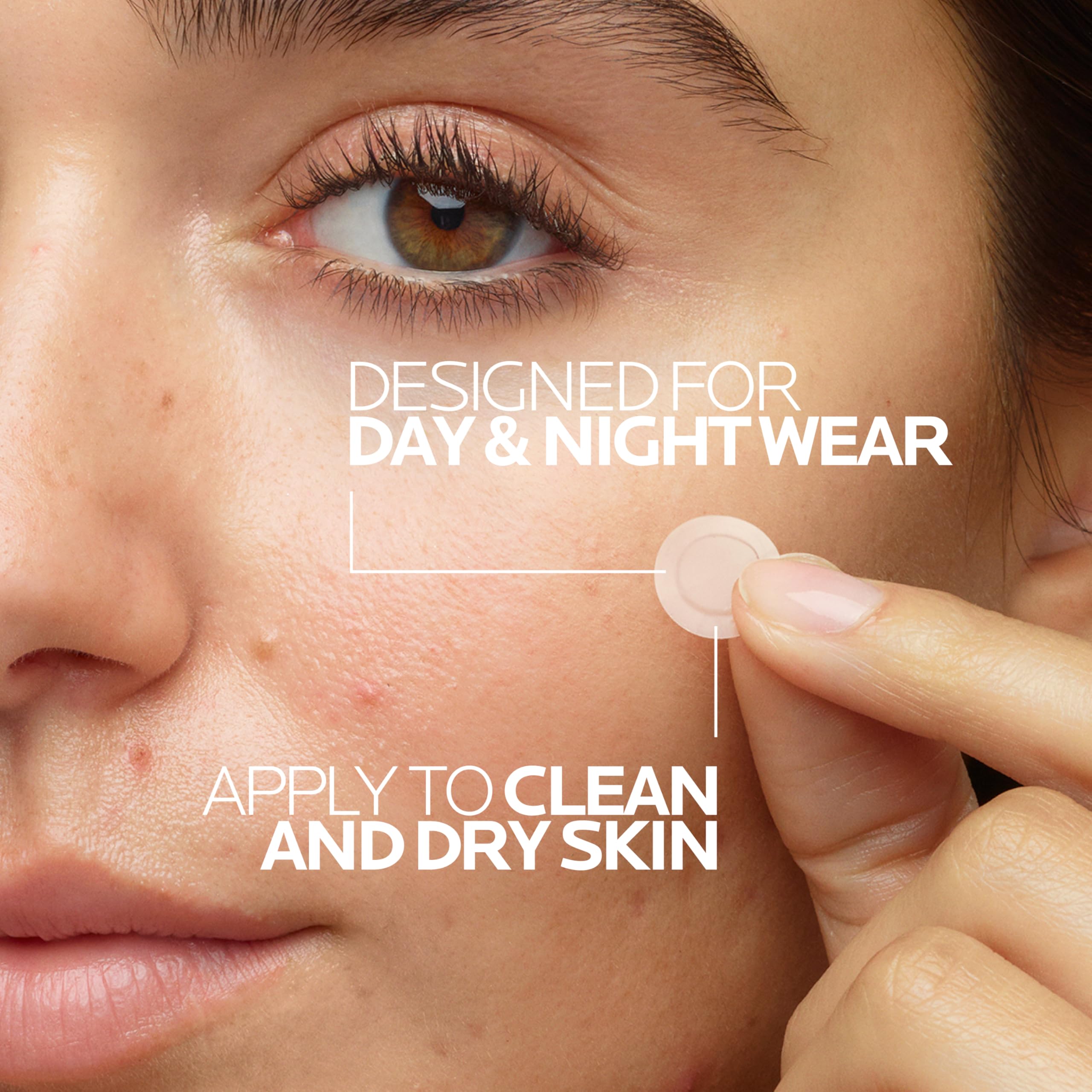 Hydrocolloid pimple patches applied on skin close up