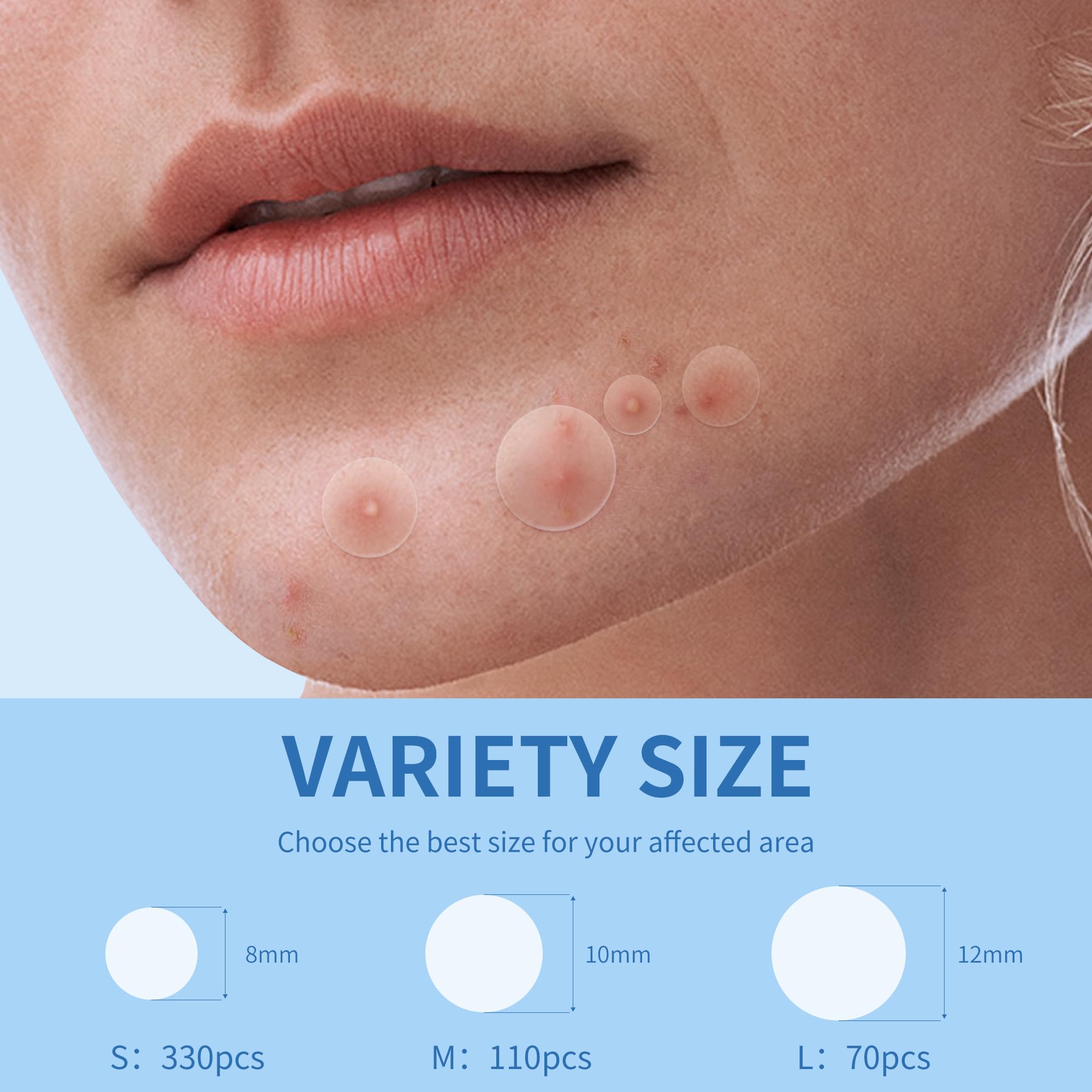 Daolyo acne patches infused with salicylic acid and tea tree oil for blemishes.